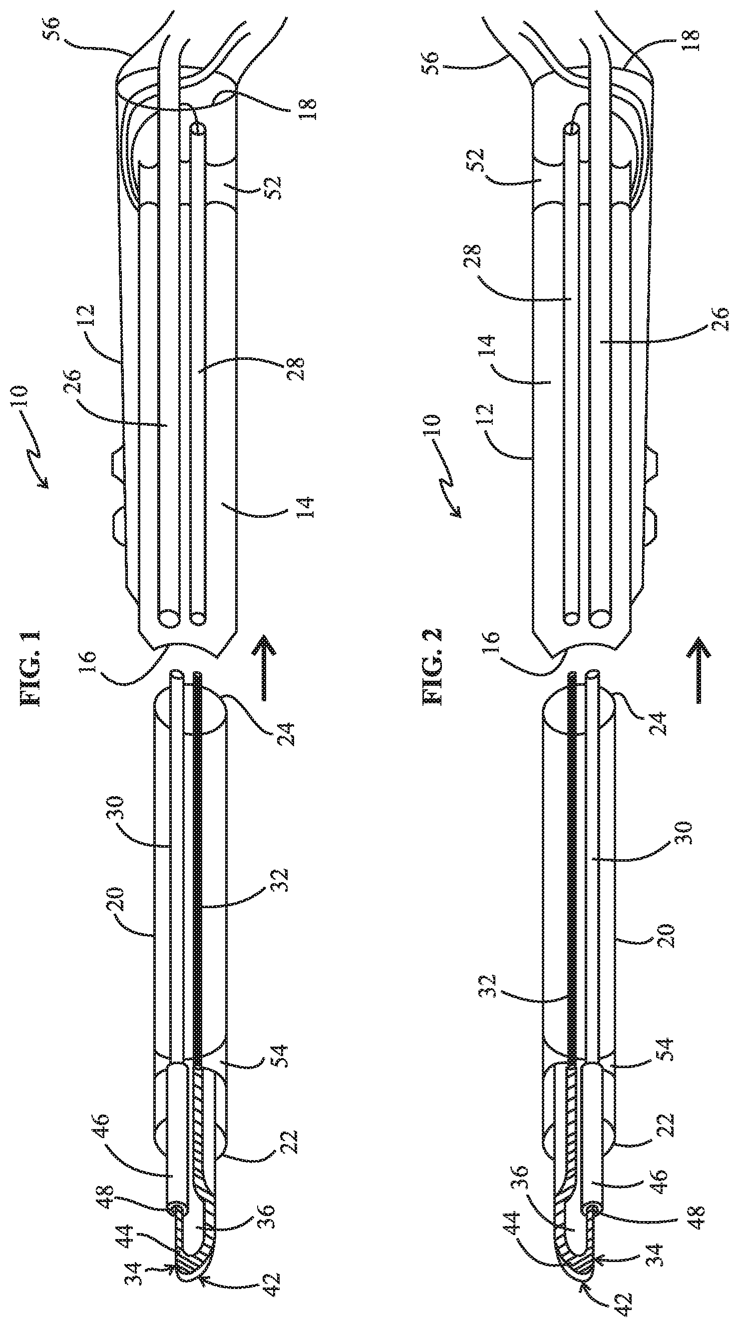 Patent US12318129 — Monopolar telescopic electrosurgery pencil — Figure 1