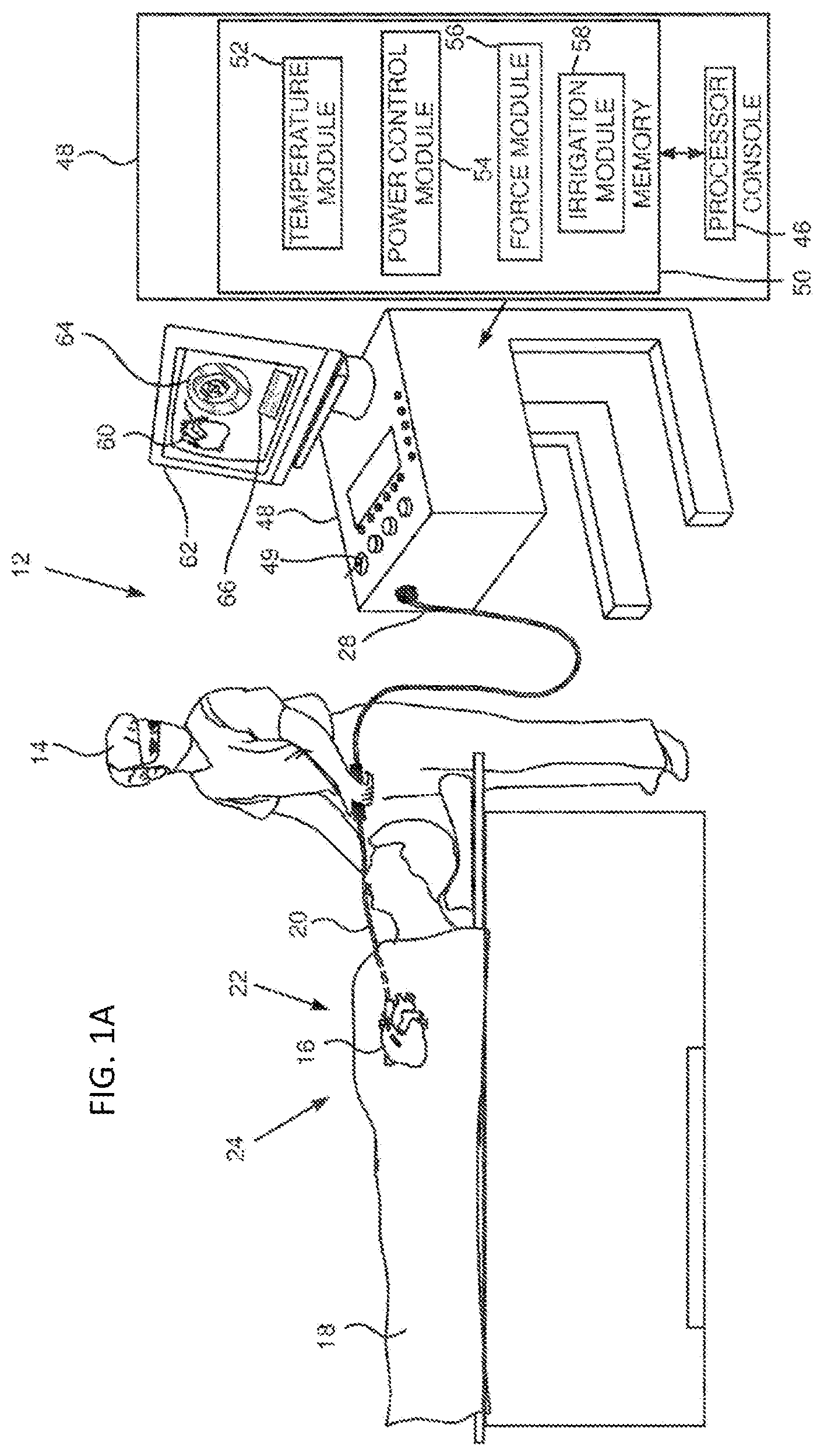 Patent US12318132 — System and method for temperature control in irrigated ablation — Figure 1