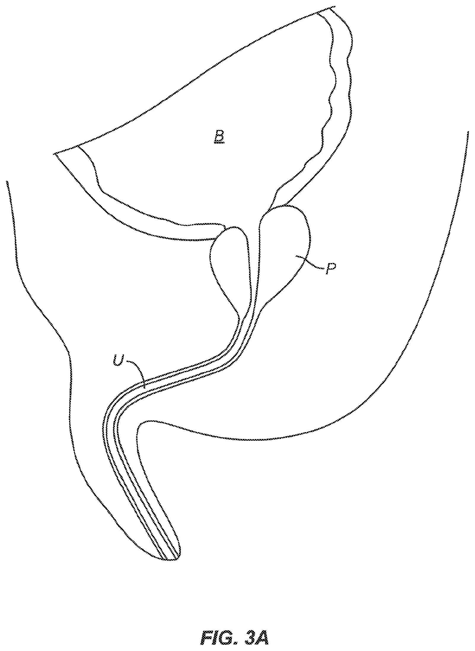 Patent US12318137 Figure 3 – Controlled tissue treatment with energy and control circuitry