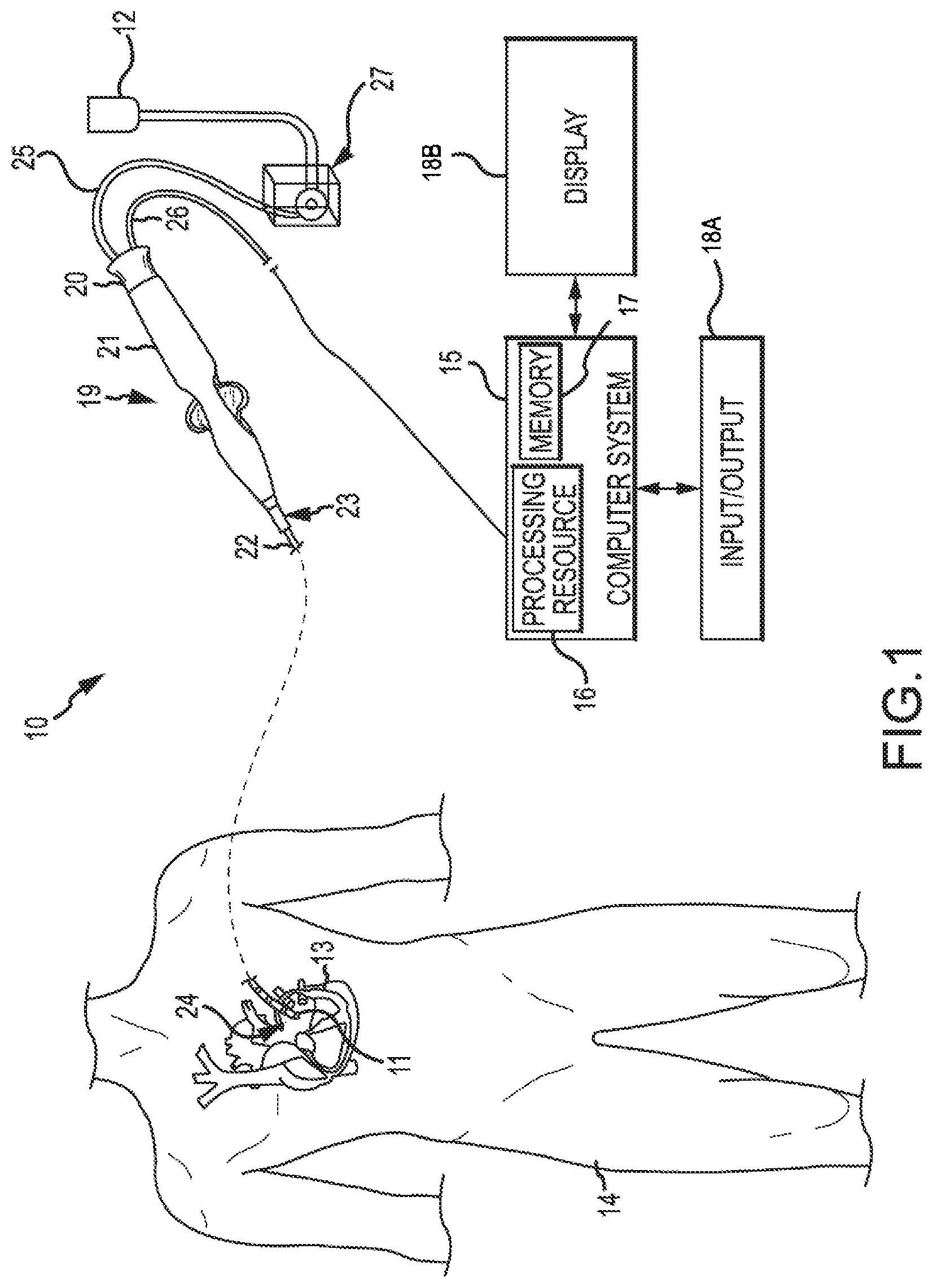 Patent US12318145 — Depicting force — Figure 1