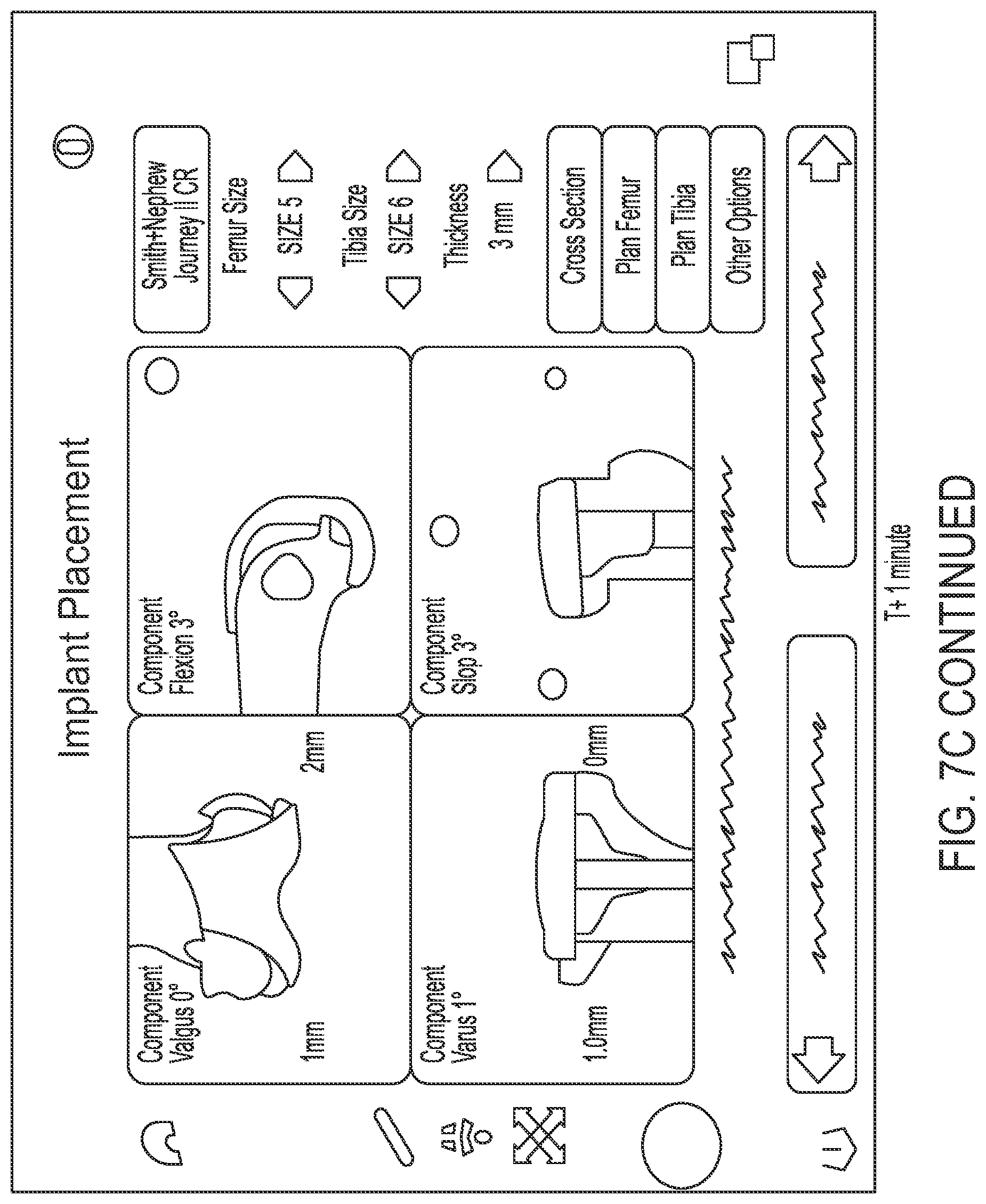 Patent US12318148 Figure 12 – Tracking device for hand tracking in surgical environment