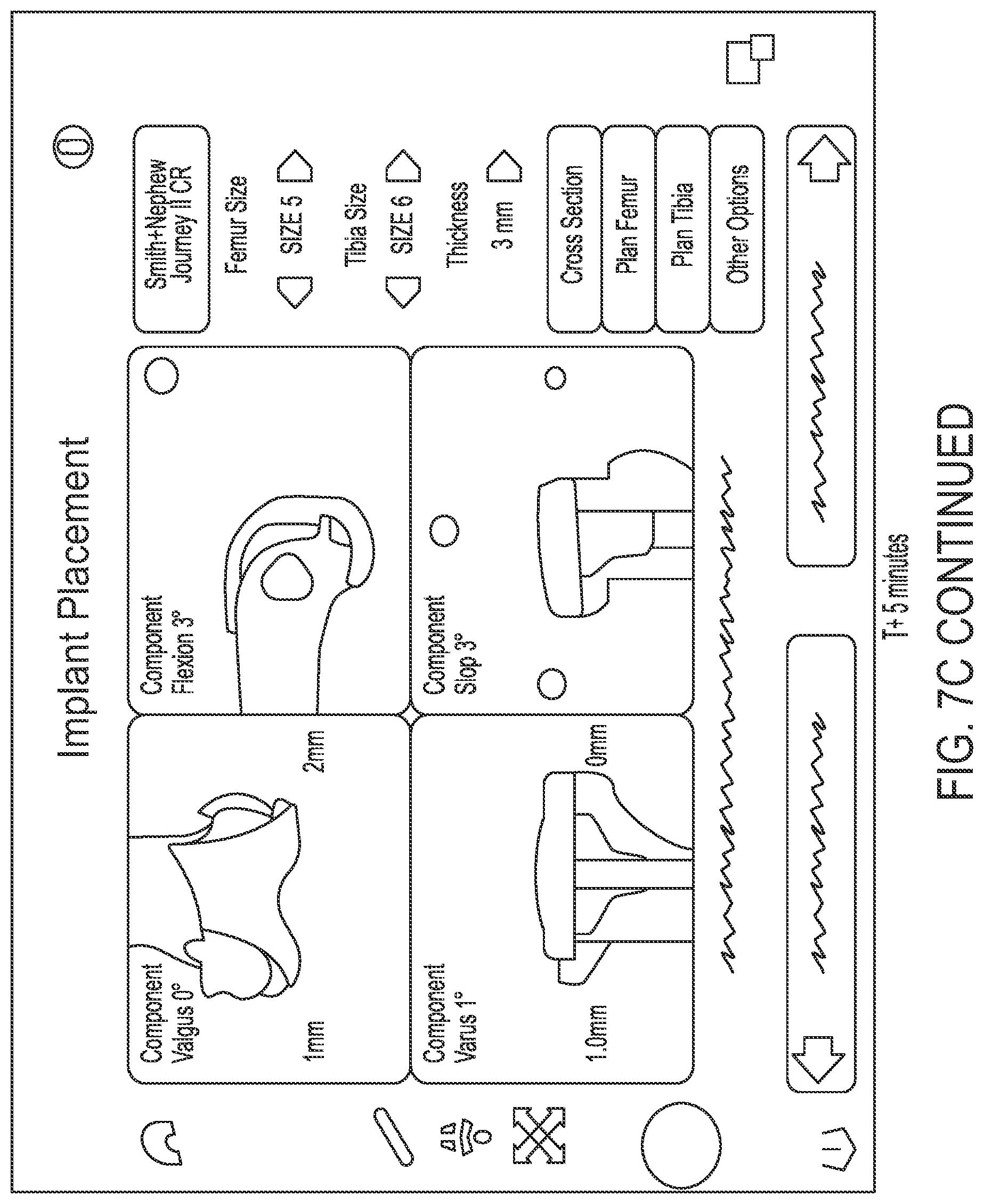 Patent US12318148 Figure 13 – Tracking device for hand tracking in surgical environment