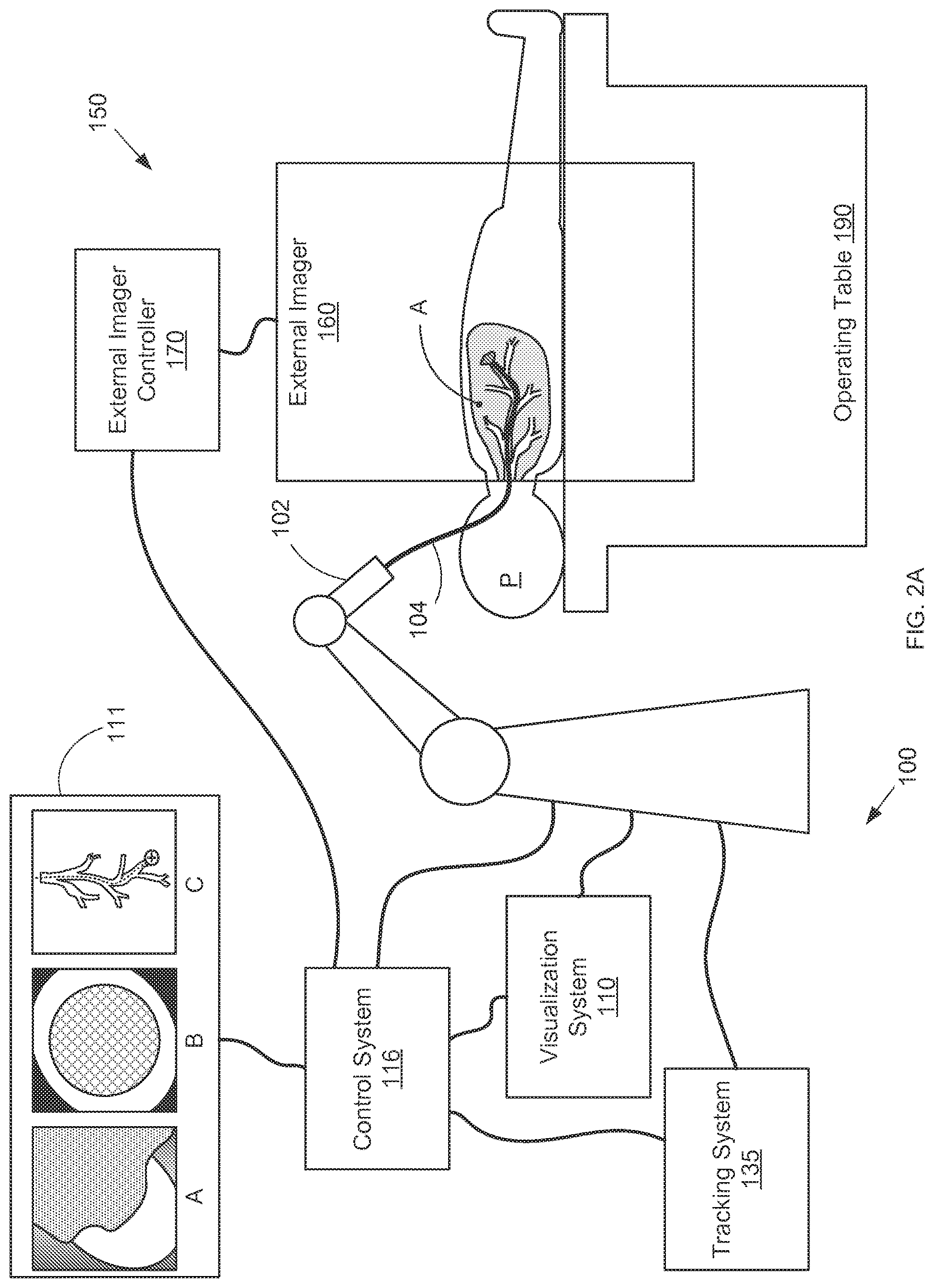 Patent US12318159 Figure 3 – Systems and methods for robotic medical system integration with external imaging