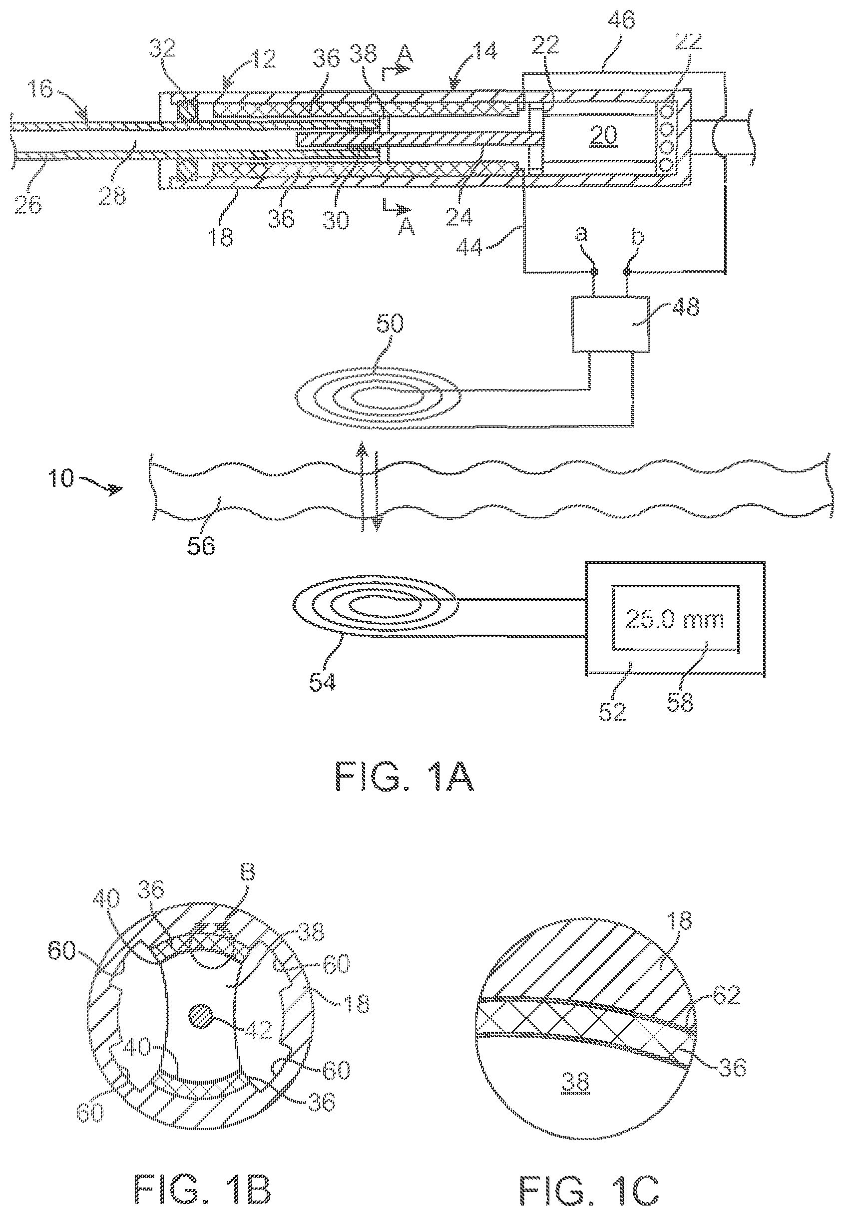 Patent US12318187 — Devices and methods for non-invasive implant length sensing — Figure 1