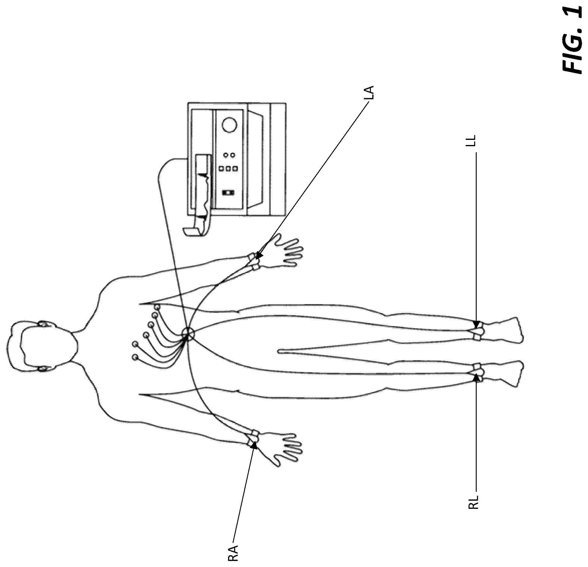 Patent US12318208 — Two-lead QT interval prediction — Figure 1