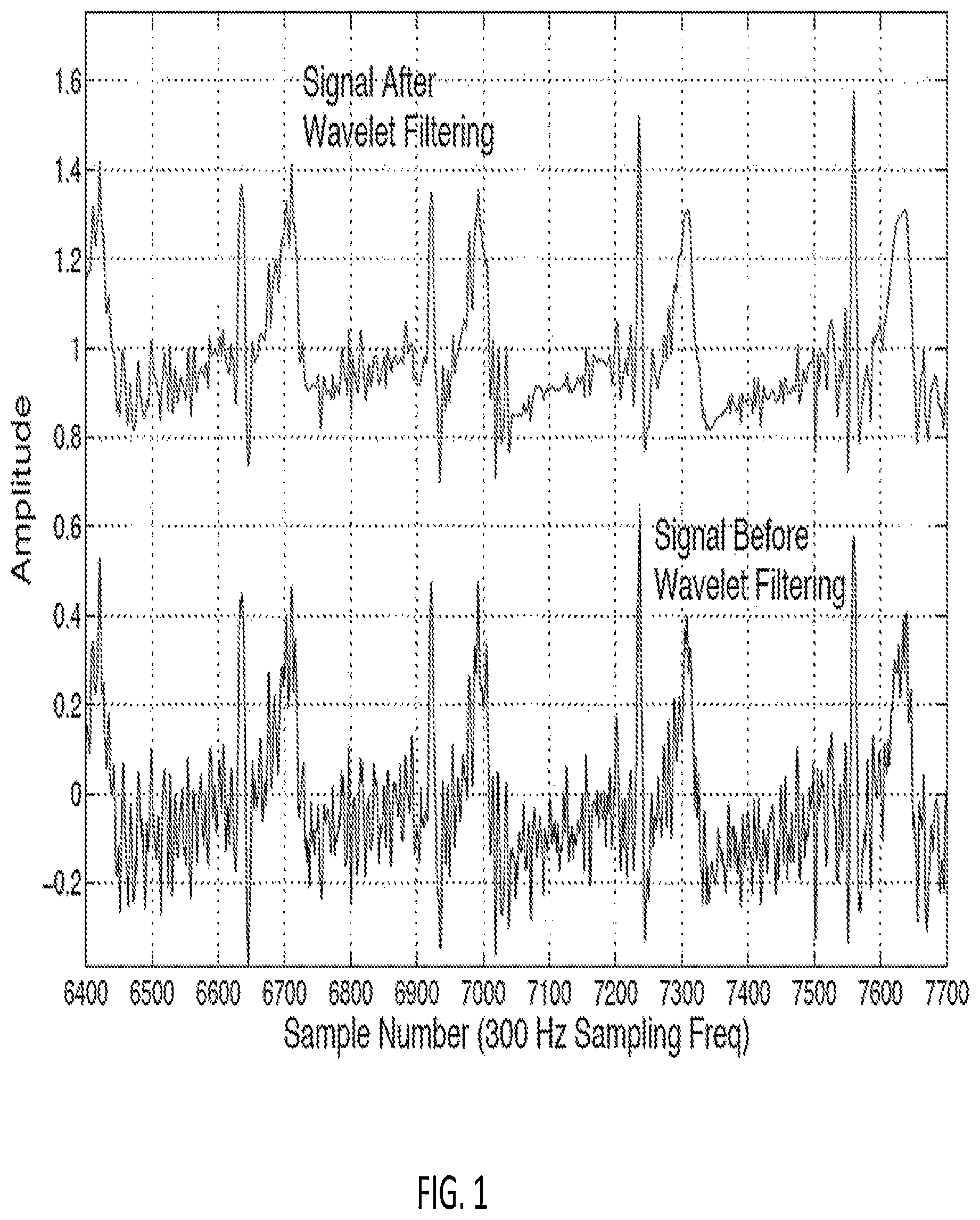 Patent US12318209 — Electrocardiogram signal detection — Figure 1