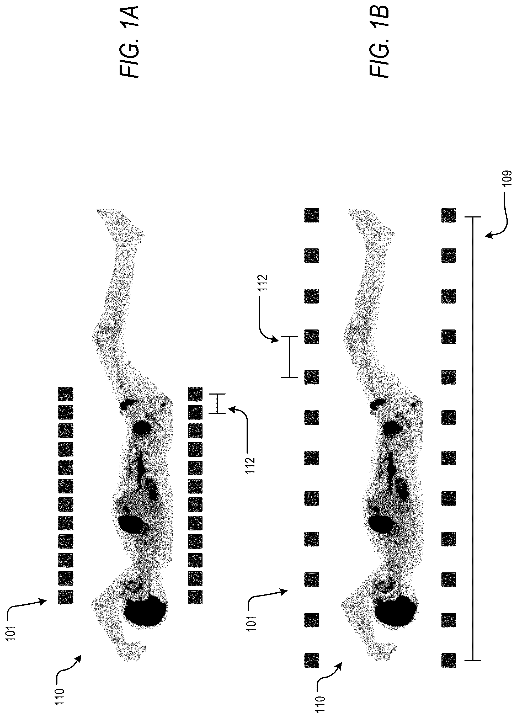 Patent US12318232 — Pet reconstruction for adjustable pet system — Figure 1