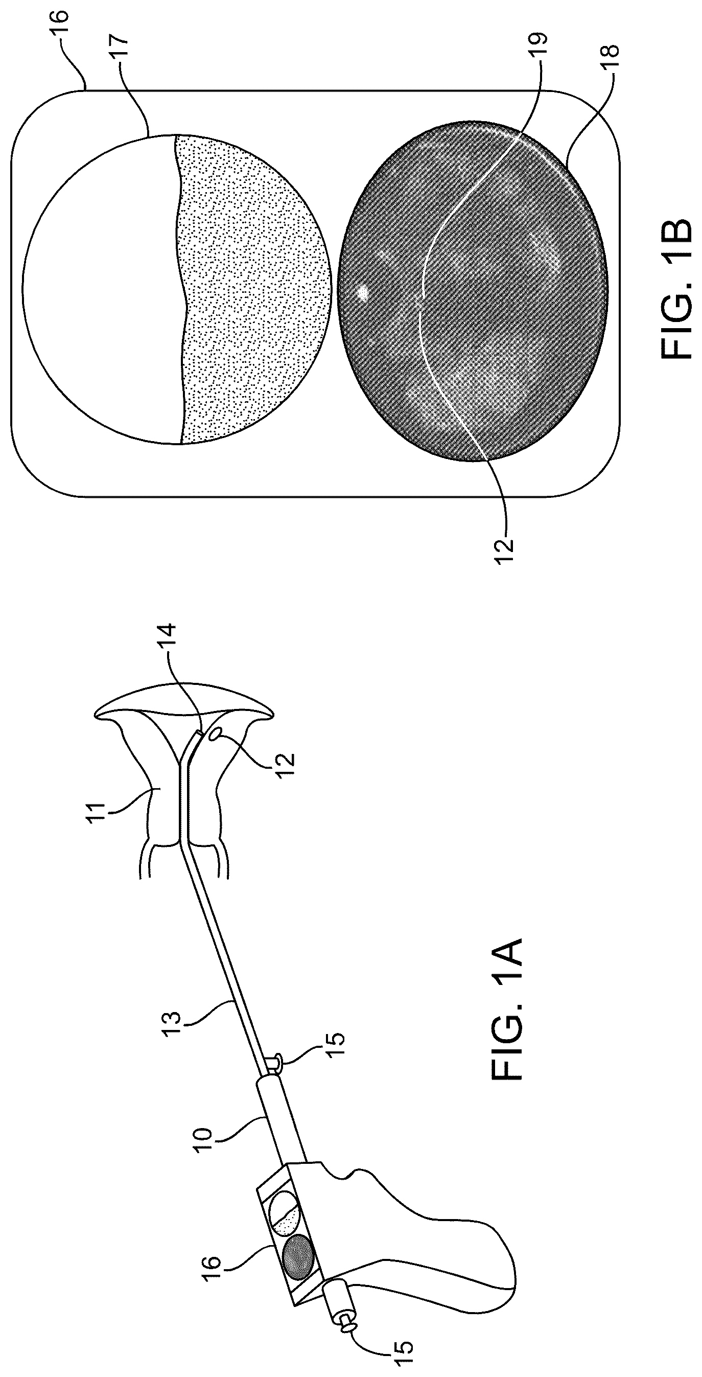 Patent US12318252 — Combined ultrasonic and direct visual hysteroscope — Figure 1