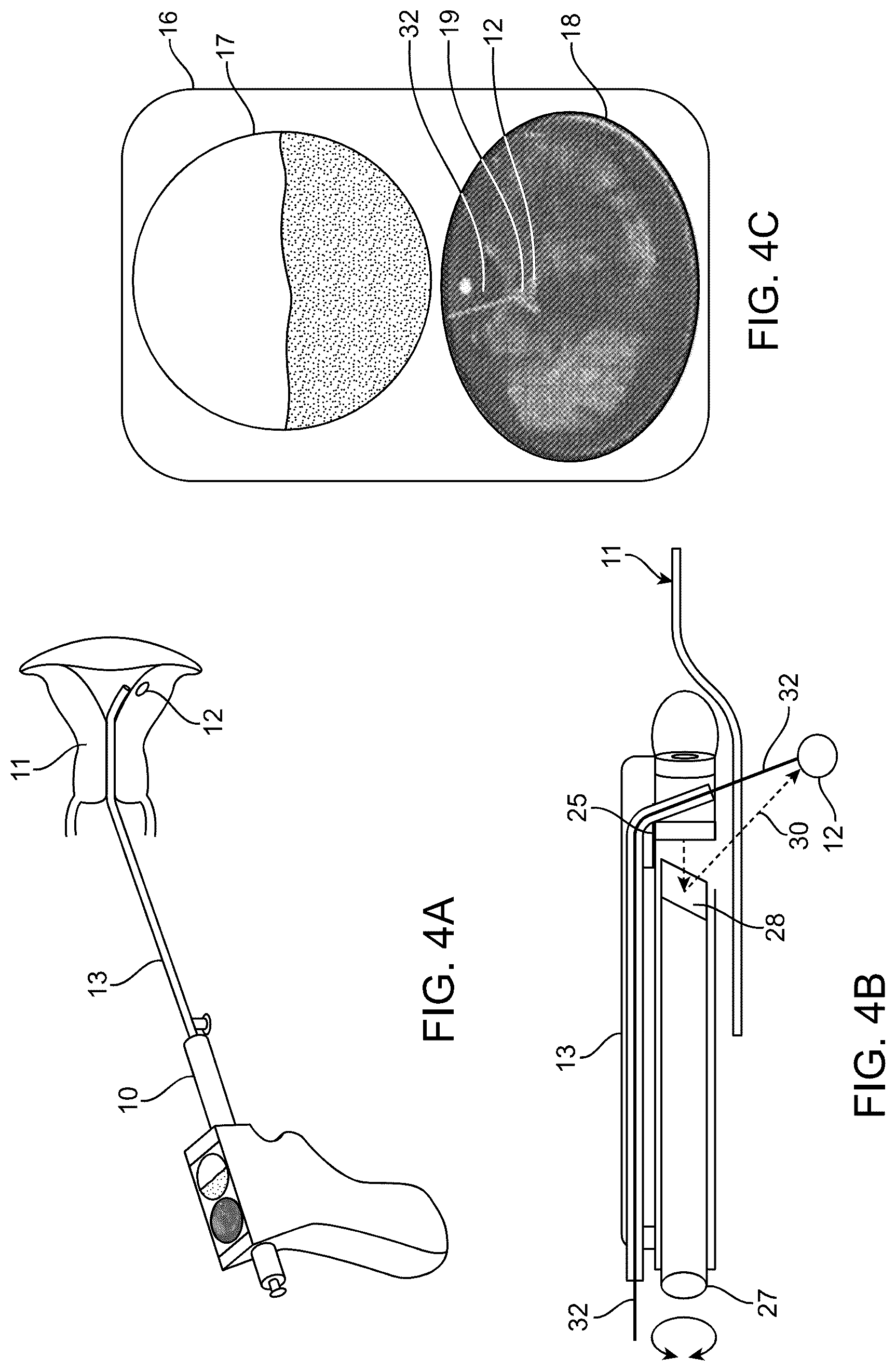 Patent US12318252 Figure 4 – Combined ultrasonic and direct visual hysteroscope