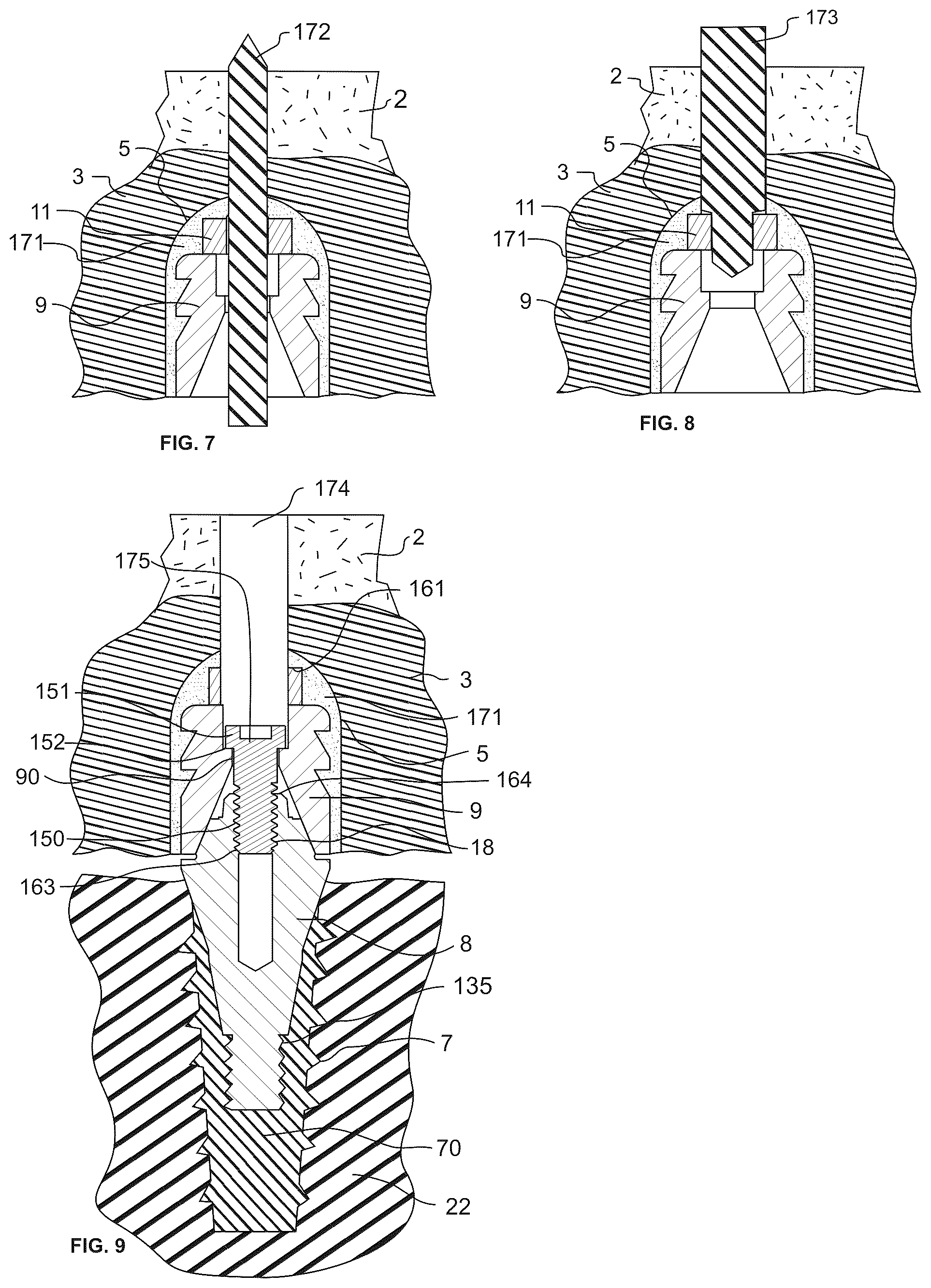 Patent US12318266 Figure 4 – Screw-attached pick-up dental coping systems and methods