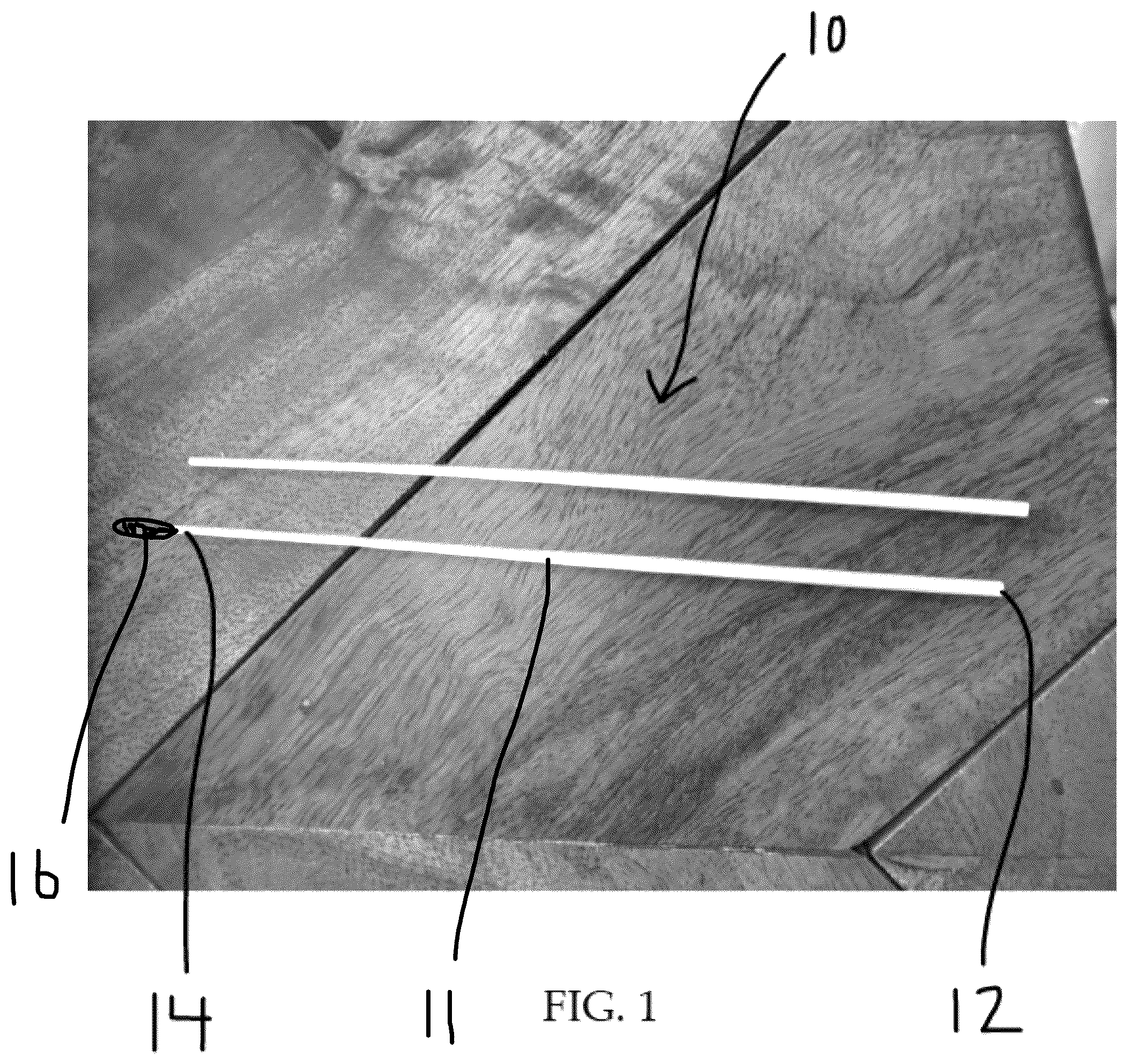 Patent US12318268 — Swab and method of manufacturing a swab — Figure 1