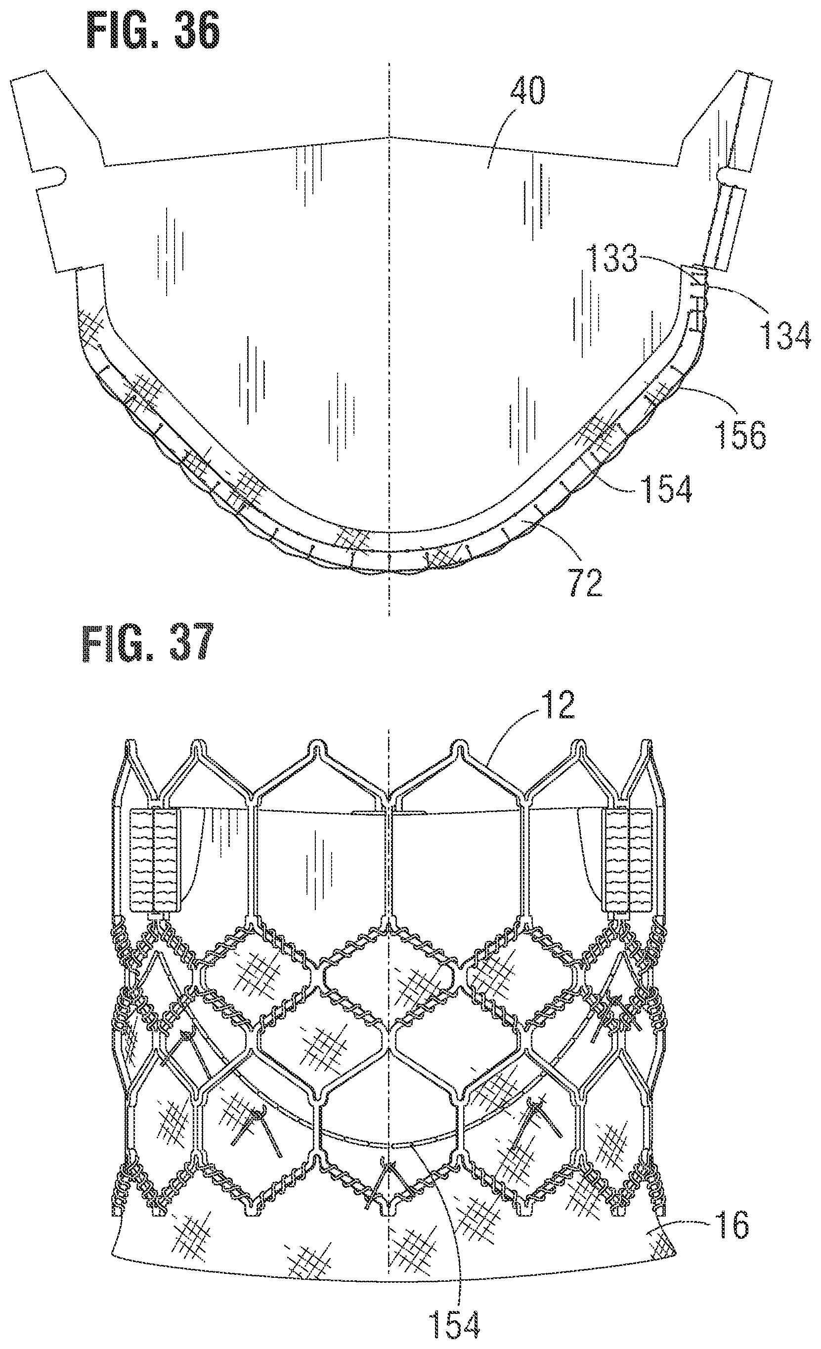 Patent US12318283 Figure 13 – Prosthetic heart valve