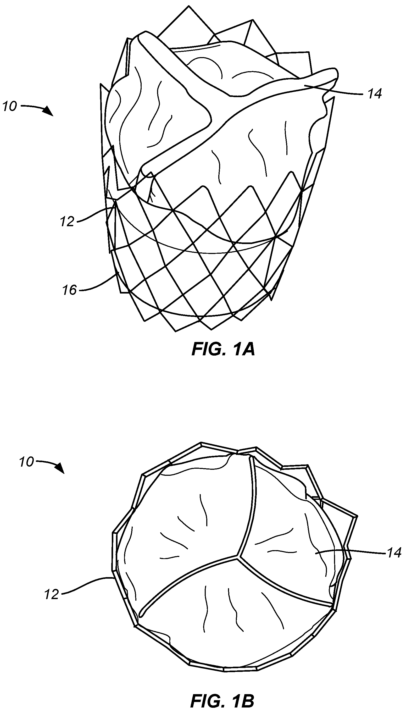 Patent US12318284 — Endovascular prosthetic heart valve replacement — Figure 1