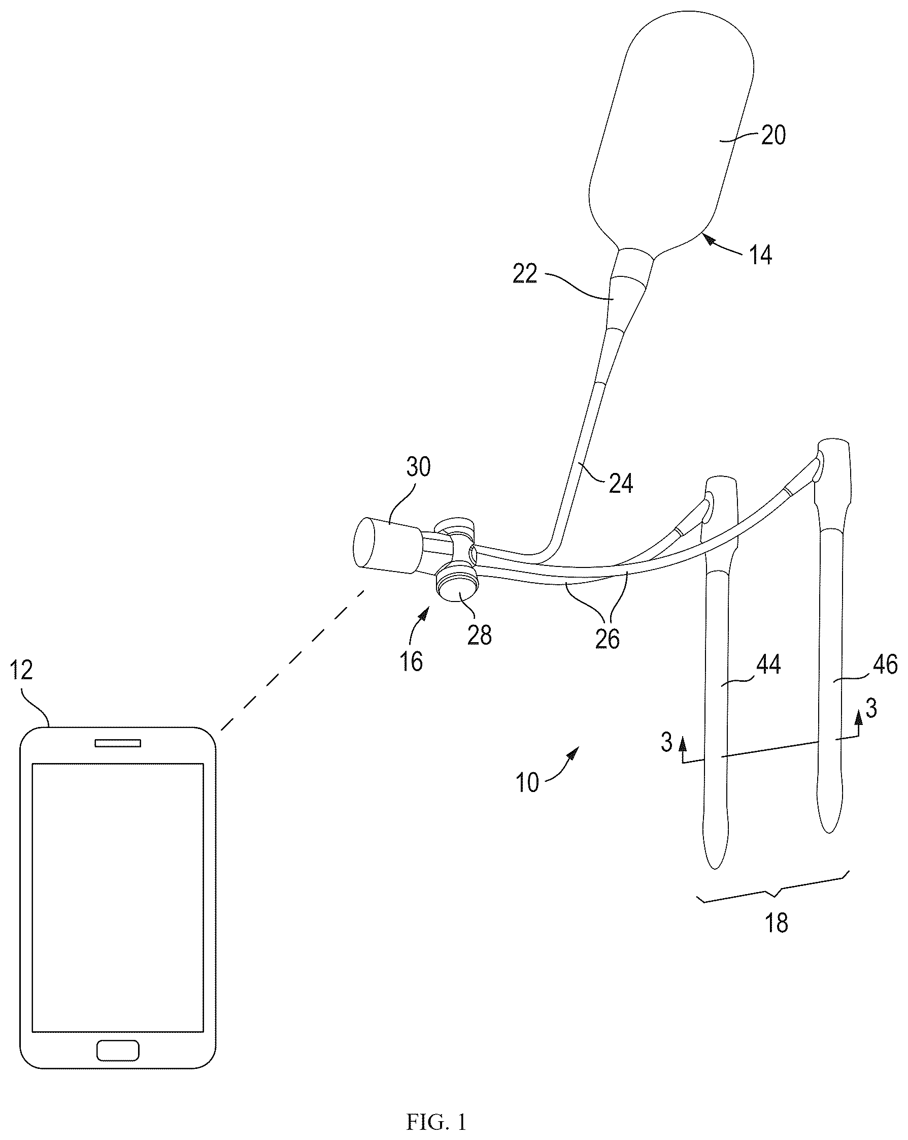 Patent US12318297 — Penile implant and method of implantation — Figure 1