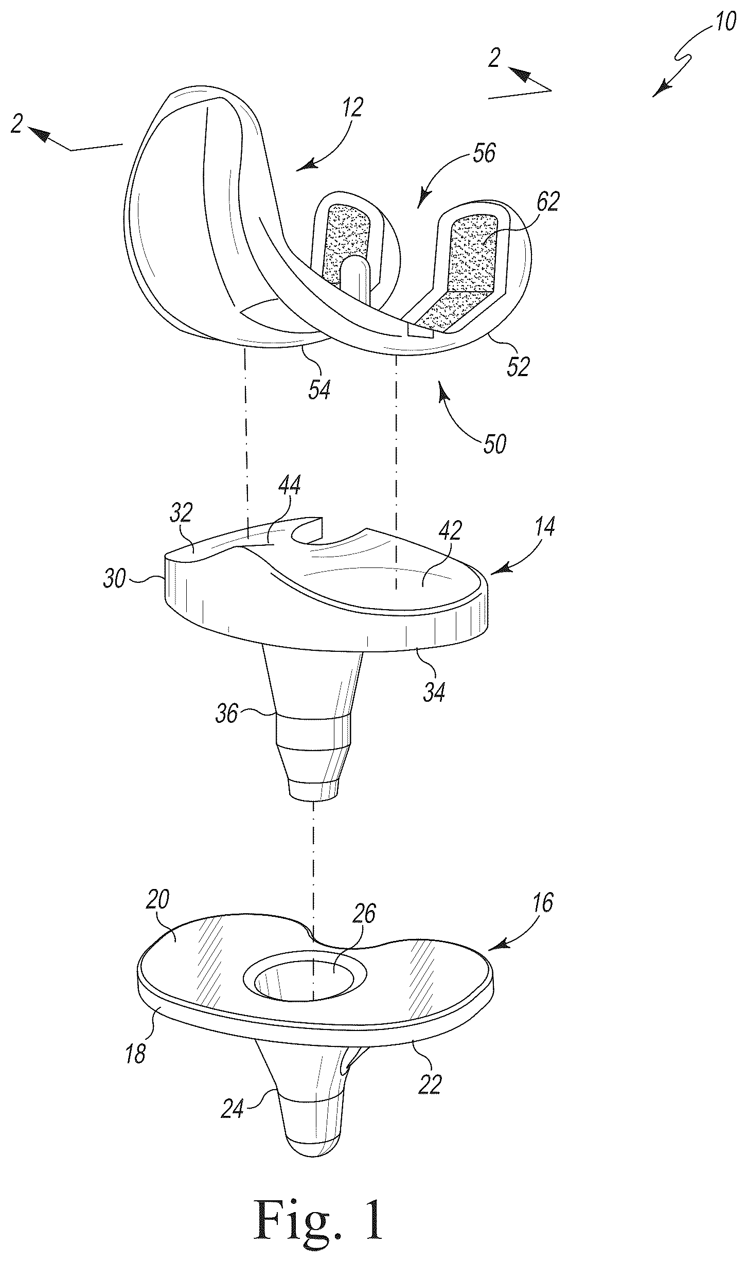 Patent US12318299 — Coated implant and method of making the same — Figure 1