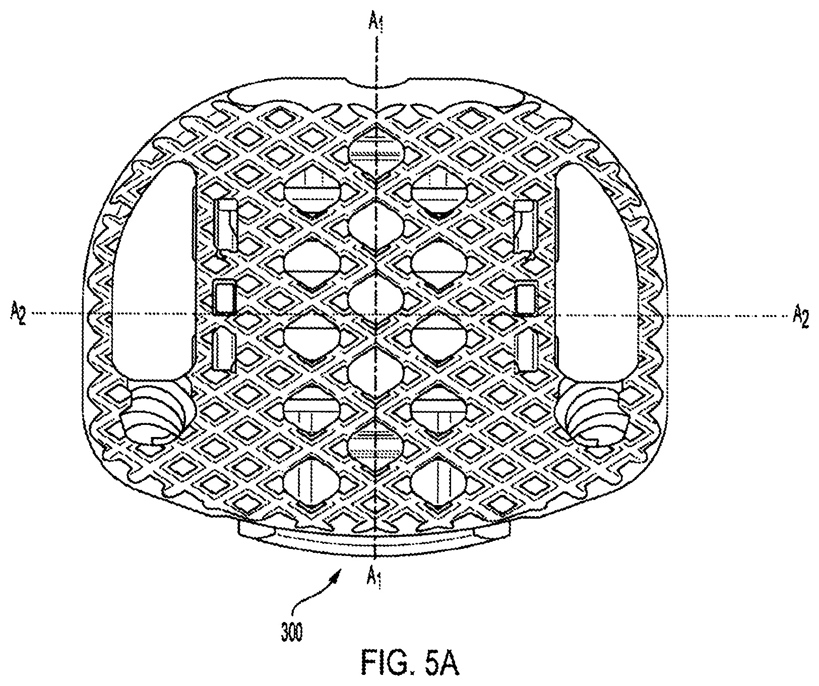 Patent US12318308 Figure 17 – Dual expandable inter-body device
