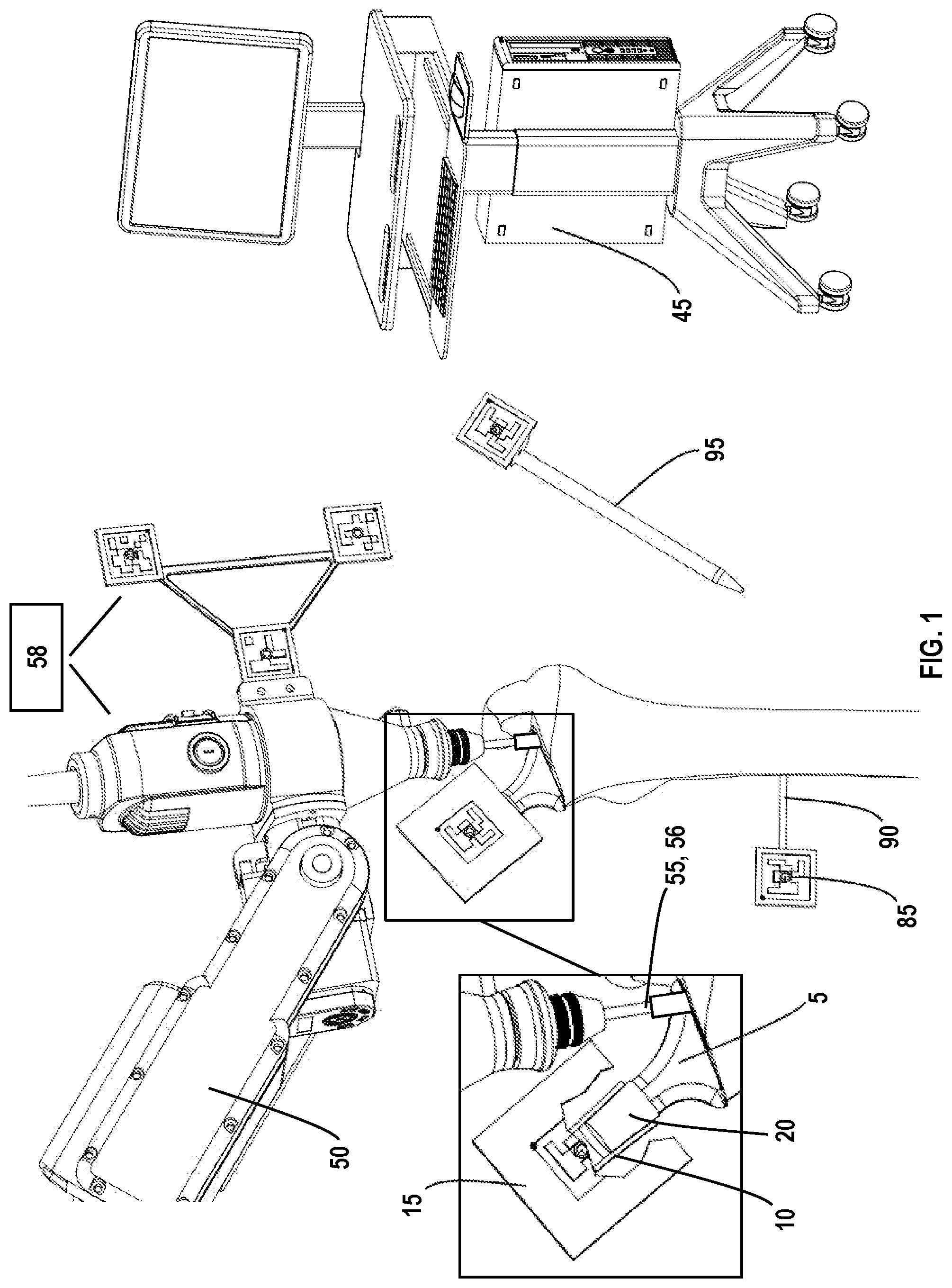 Patent US12318310 — Joint implant extraction and placement system and localization device used therewith — Figure 1