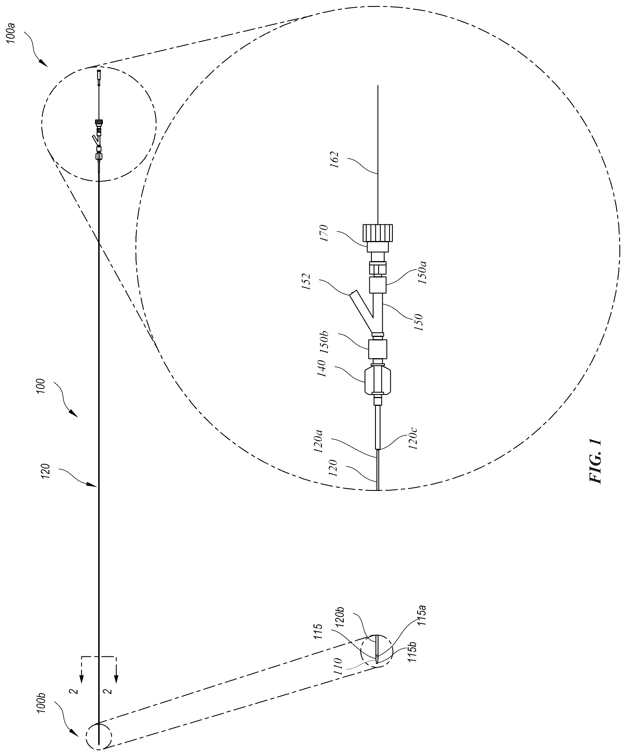 Patent US12318318 — Delivery systems for stents having protruding features — Figure 1