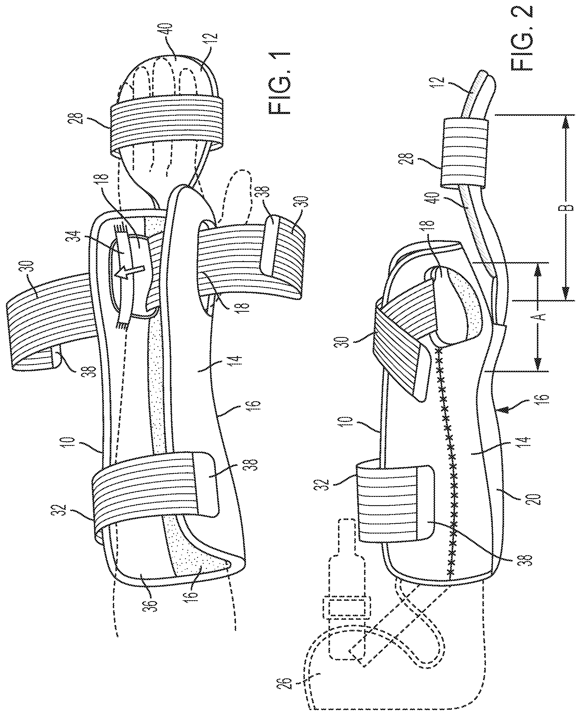 Patent US12318323 — Extendable fracture orthosis — Figure 1
