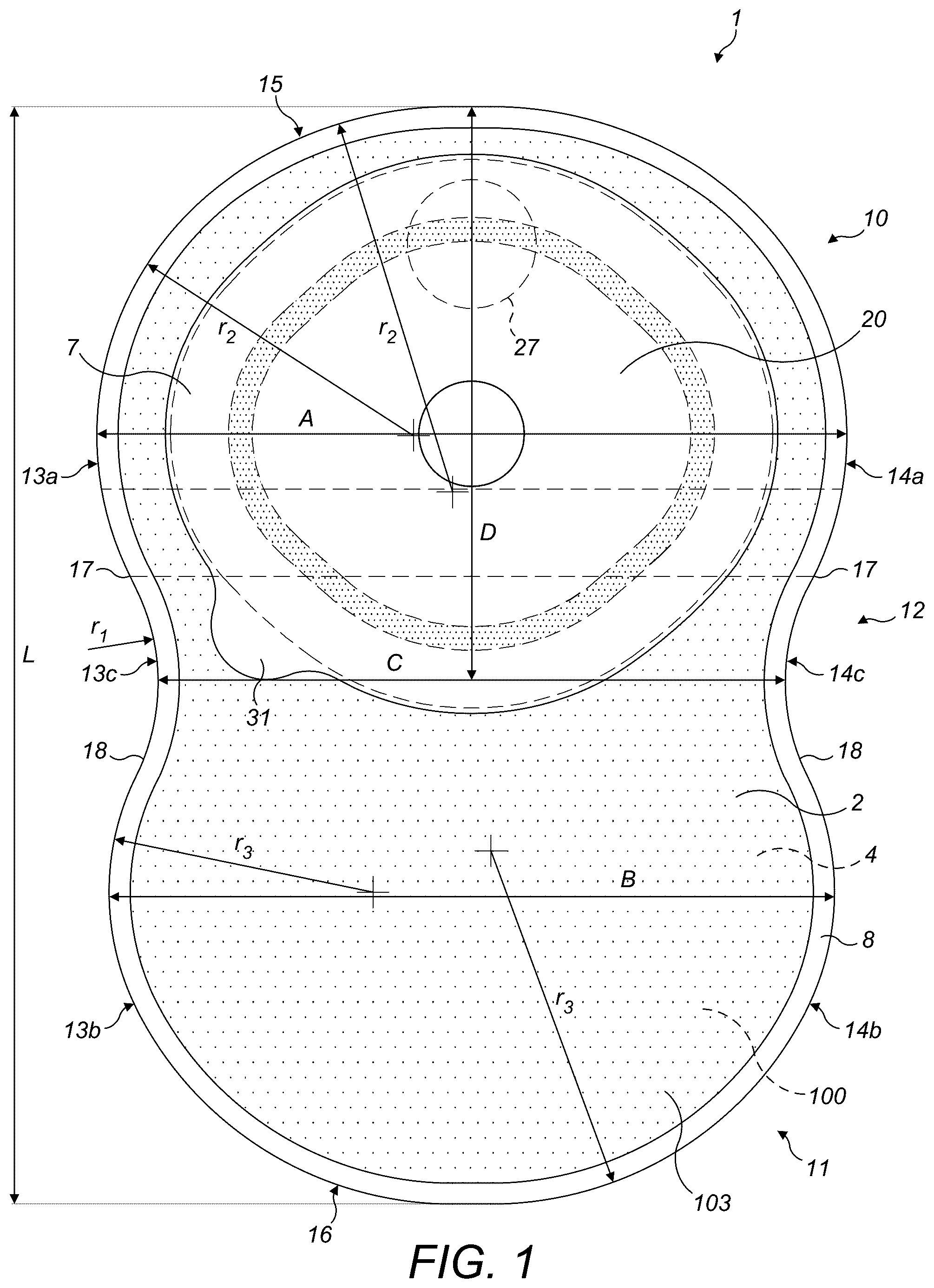 Patent US12318324 Figure 1 – Ostomy appliance