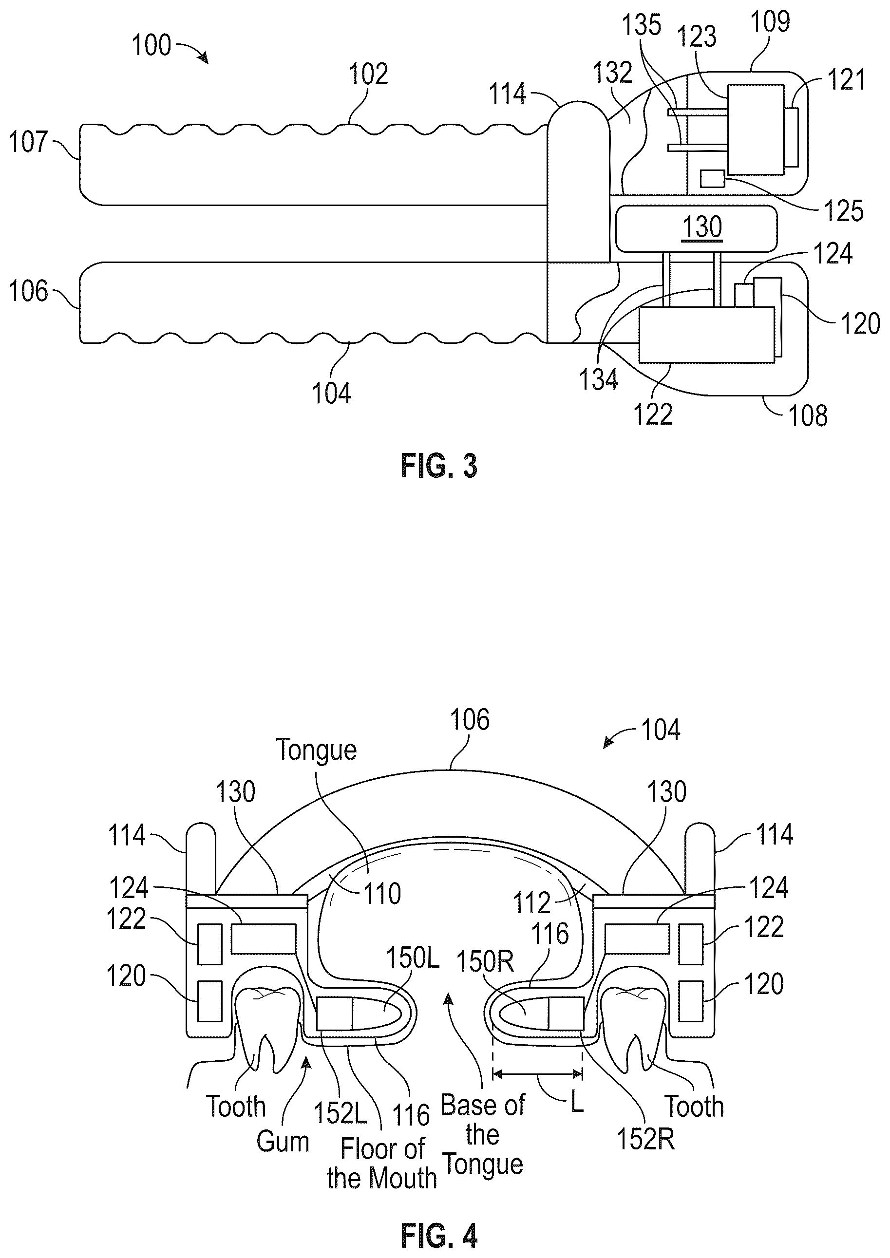 Patent US12318325 Figure 2 – Maxillary and mandibular devices that prevent disengagement therebetween, controller station, and methods of treating and/or diagnosing medical disorders