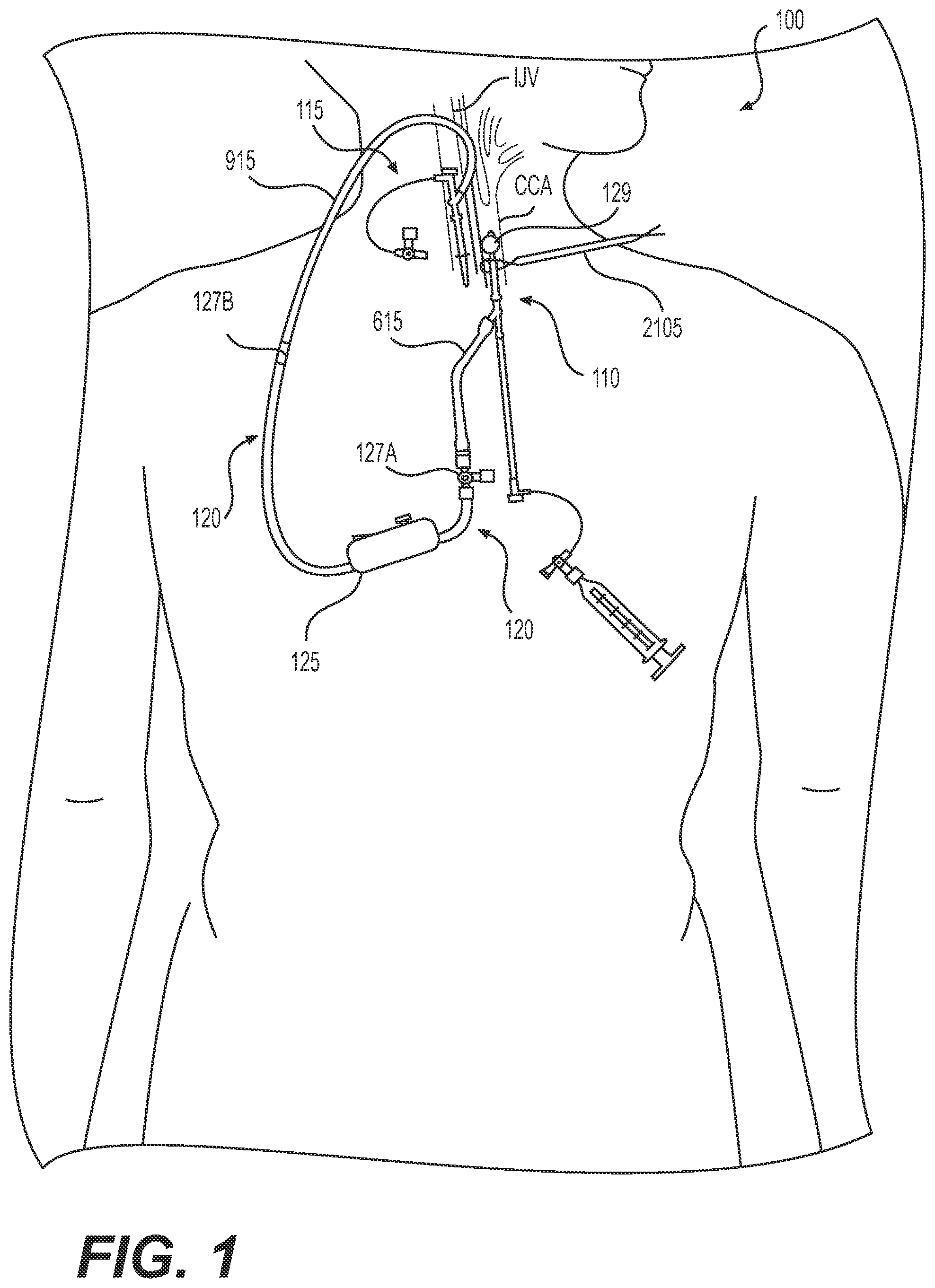 Patent US12318327 Figure 1 – Systems and methods for treating eye diseases