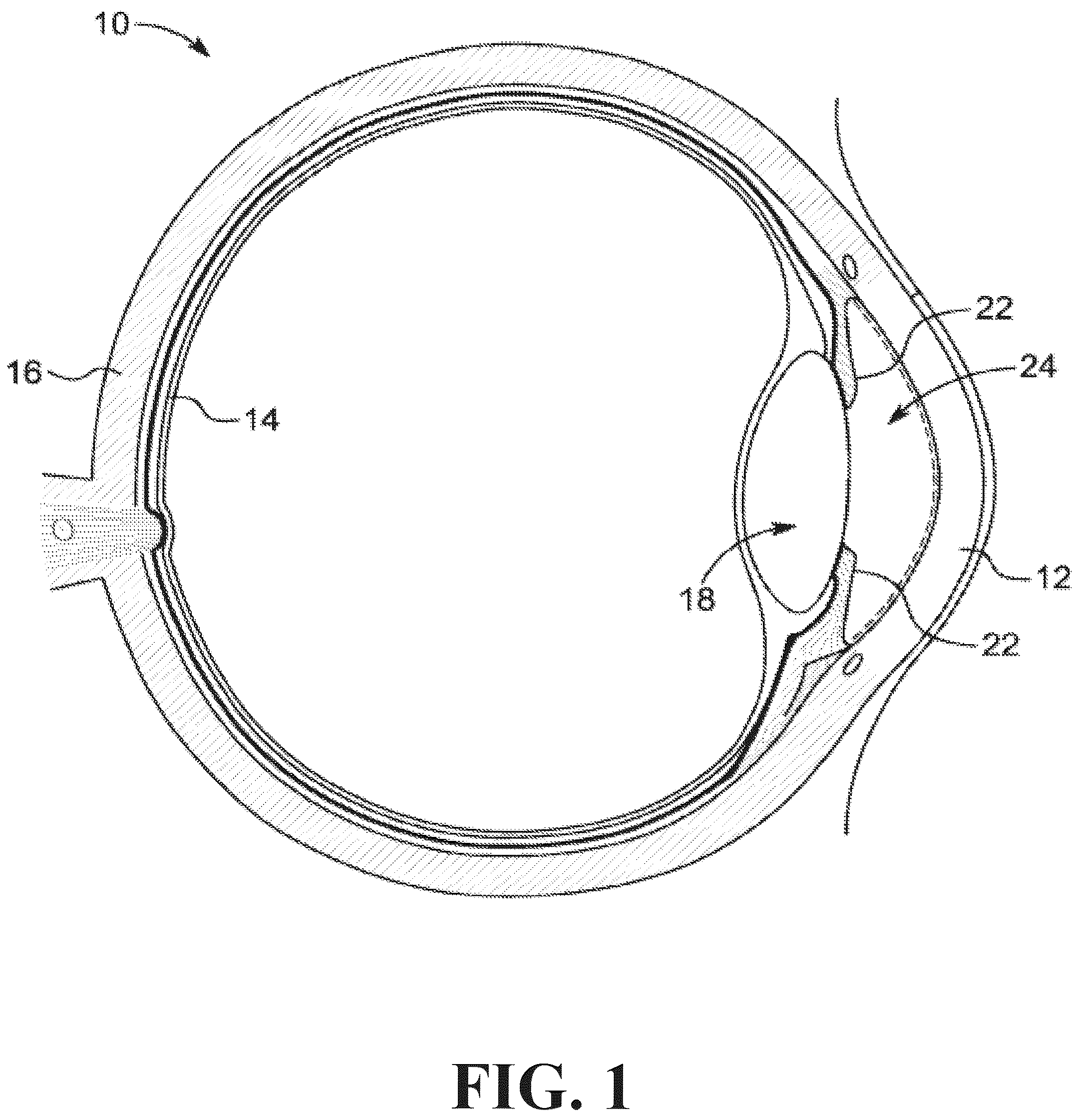 Patent US12318331 — Intraocular lens docking station — Figure 1