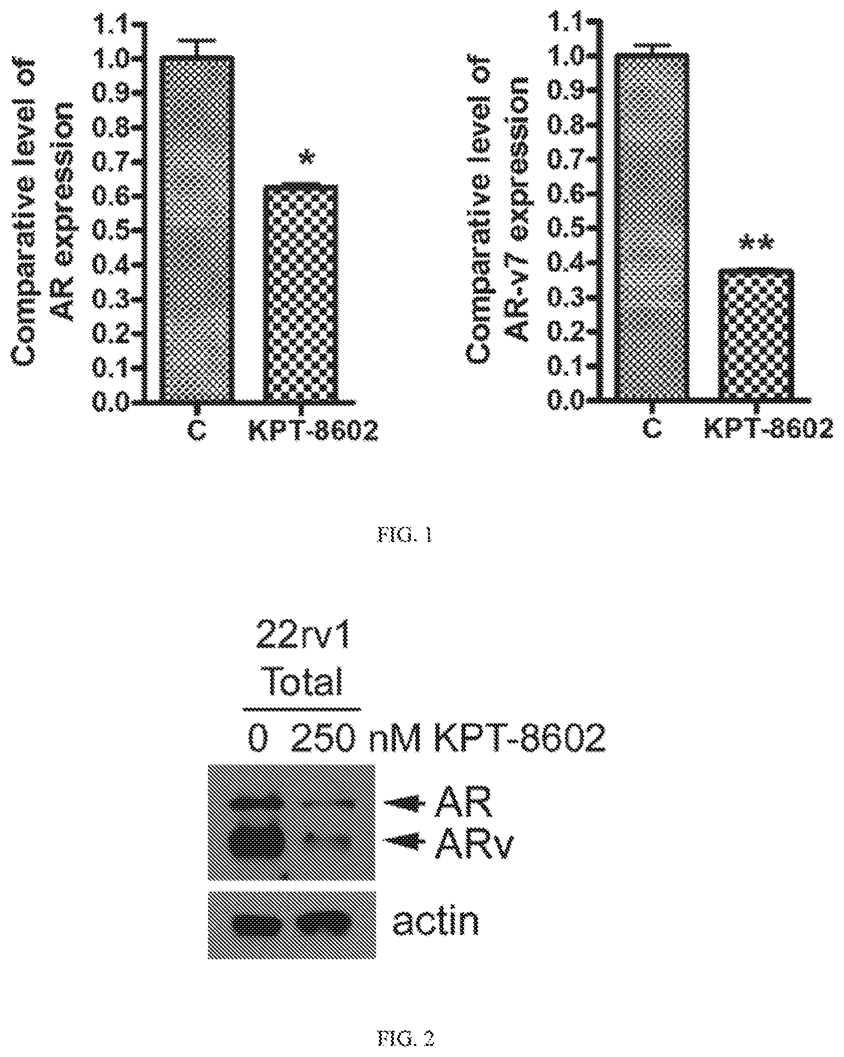 Patent US12318386 Figure 1 – Combination of XPO1 inhibitors and second agents for the treatment of prostate cancer