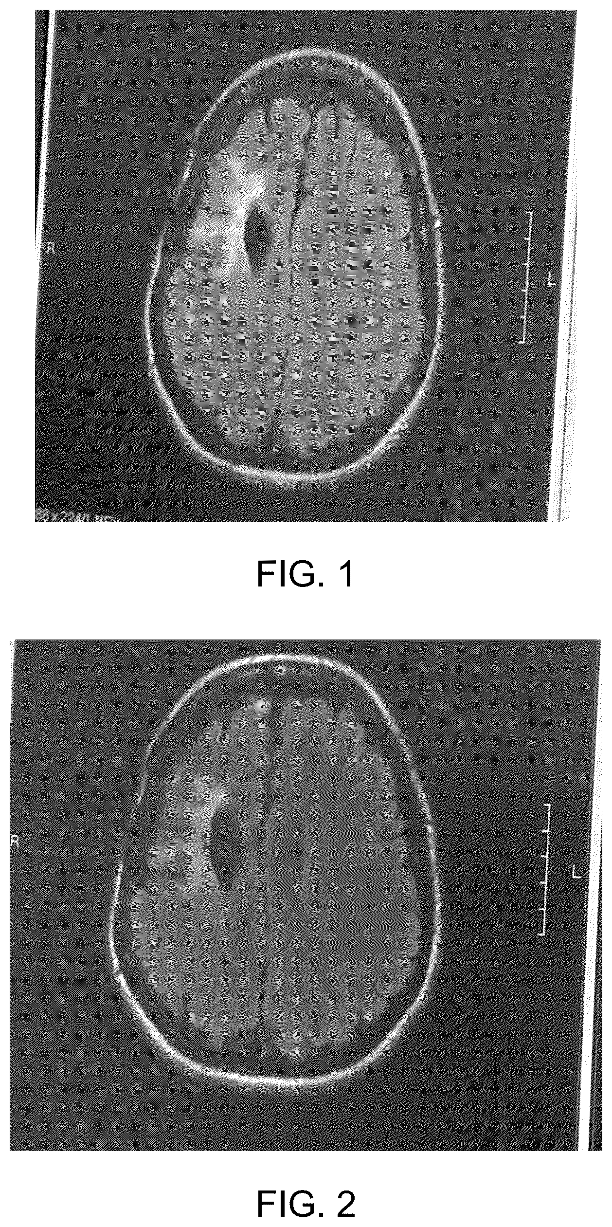 Patent US12318420 — Herbal formulations of carnivorous plants and methods for treating inflammation — Figure 1
