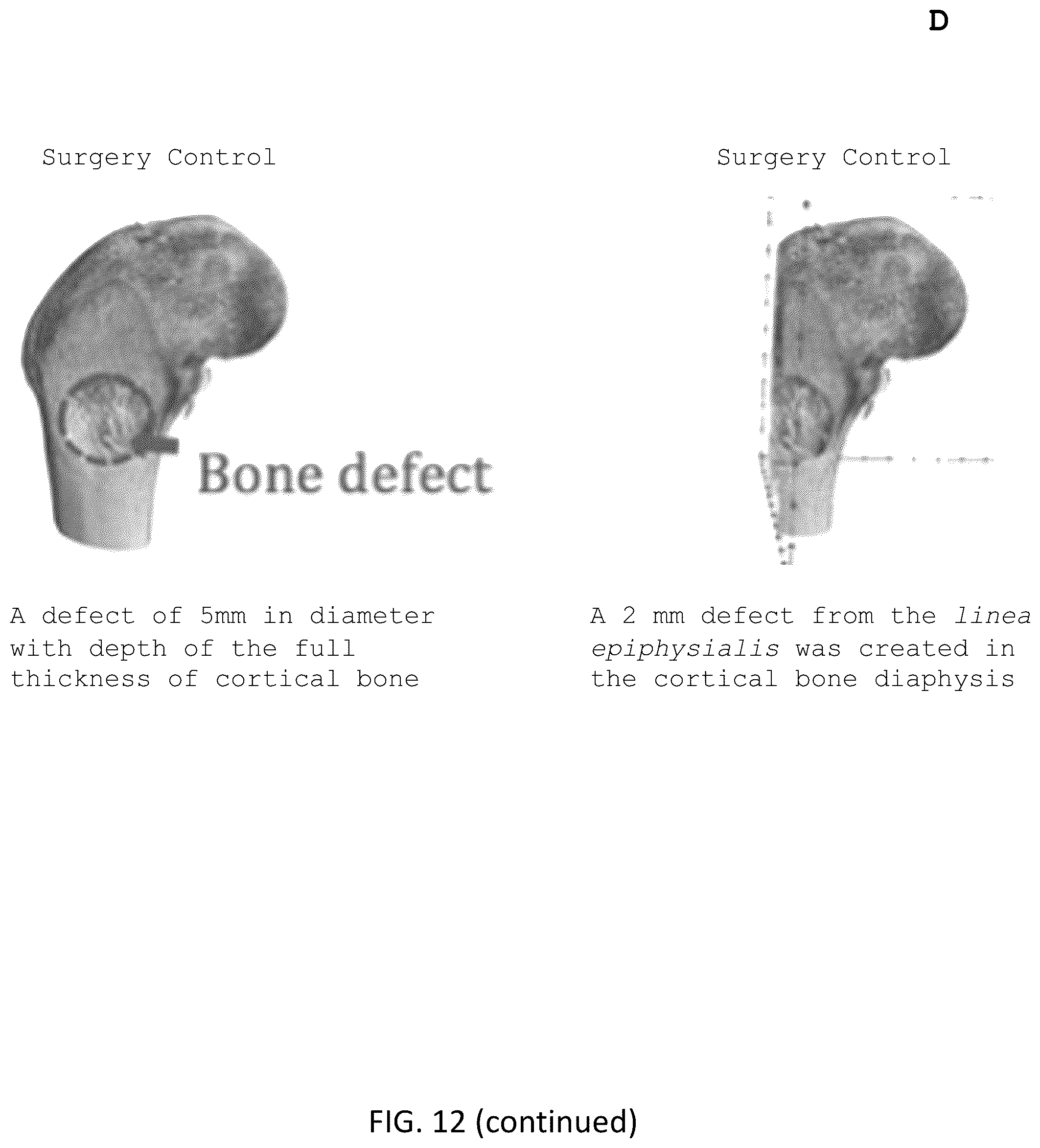 Patent US12318504 Figure 10 – Method for manufacturing a calcified tissue substitute
