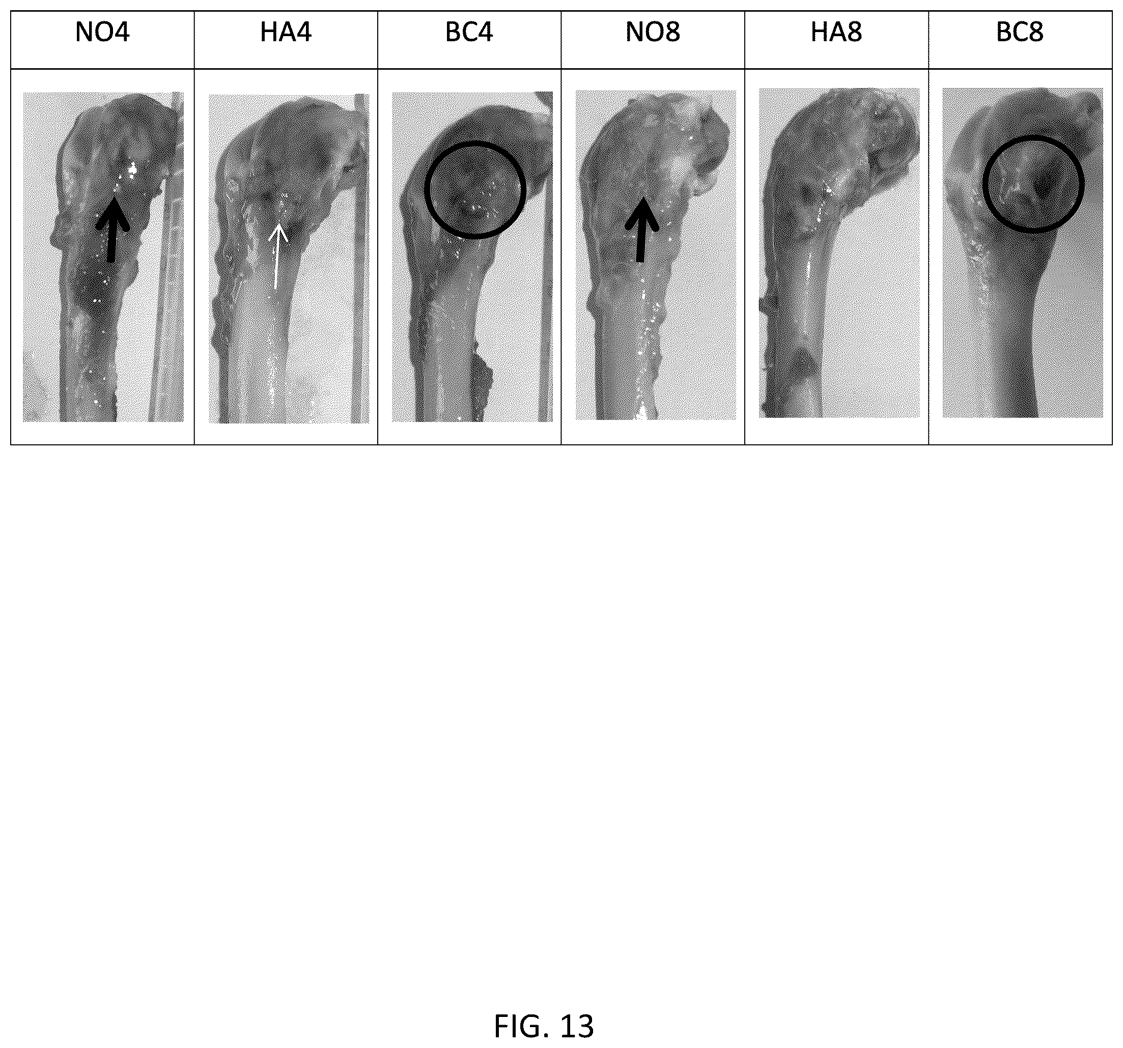 Patent US12318504 Figure 11 – Method for manufacturing a calcified tissue substitute