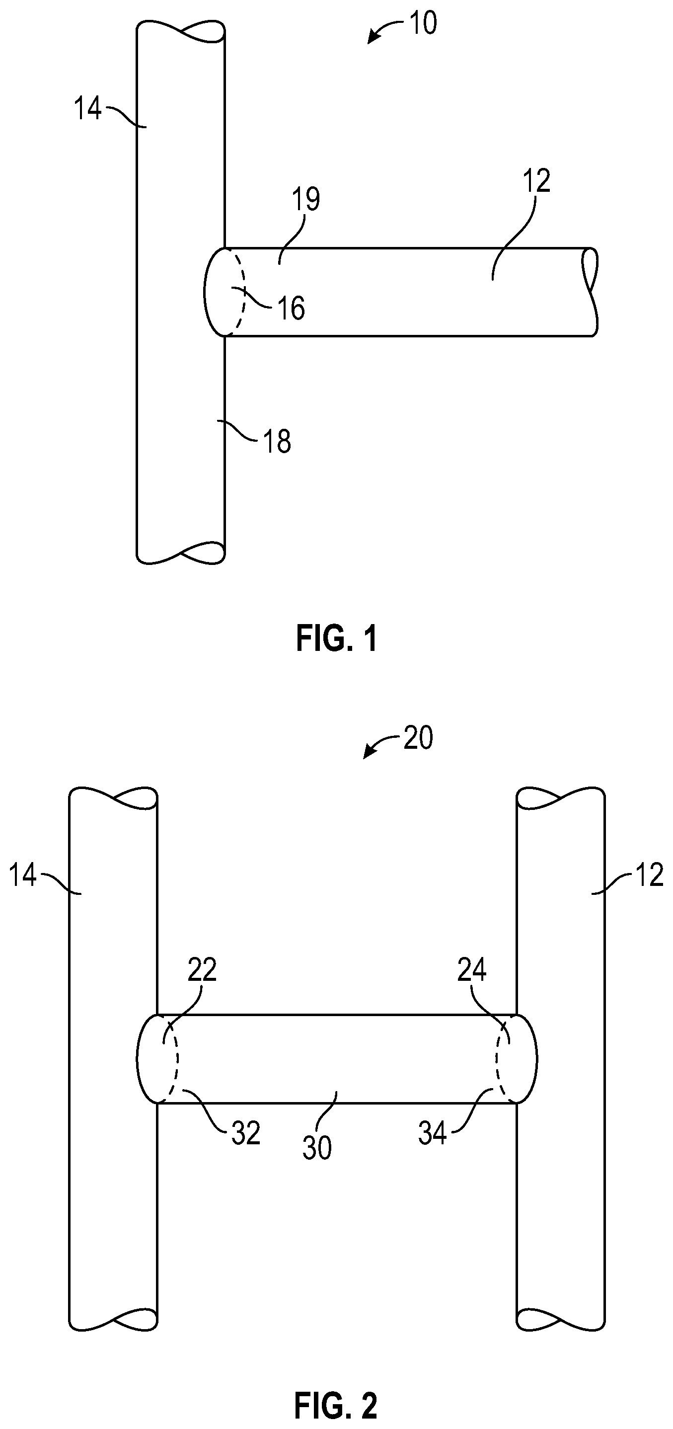 Patent US12318528 — Variable orifice fistula graft — Figure 1