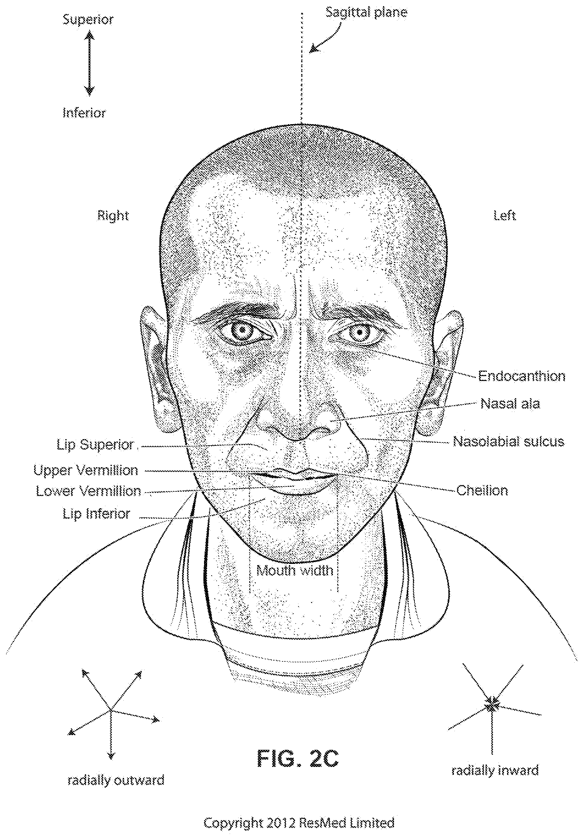 Patent US12318544 Figure 6 – Elbow assembly