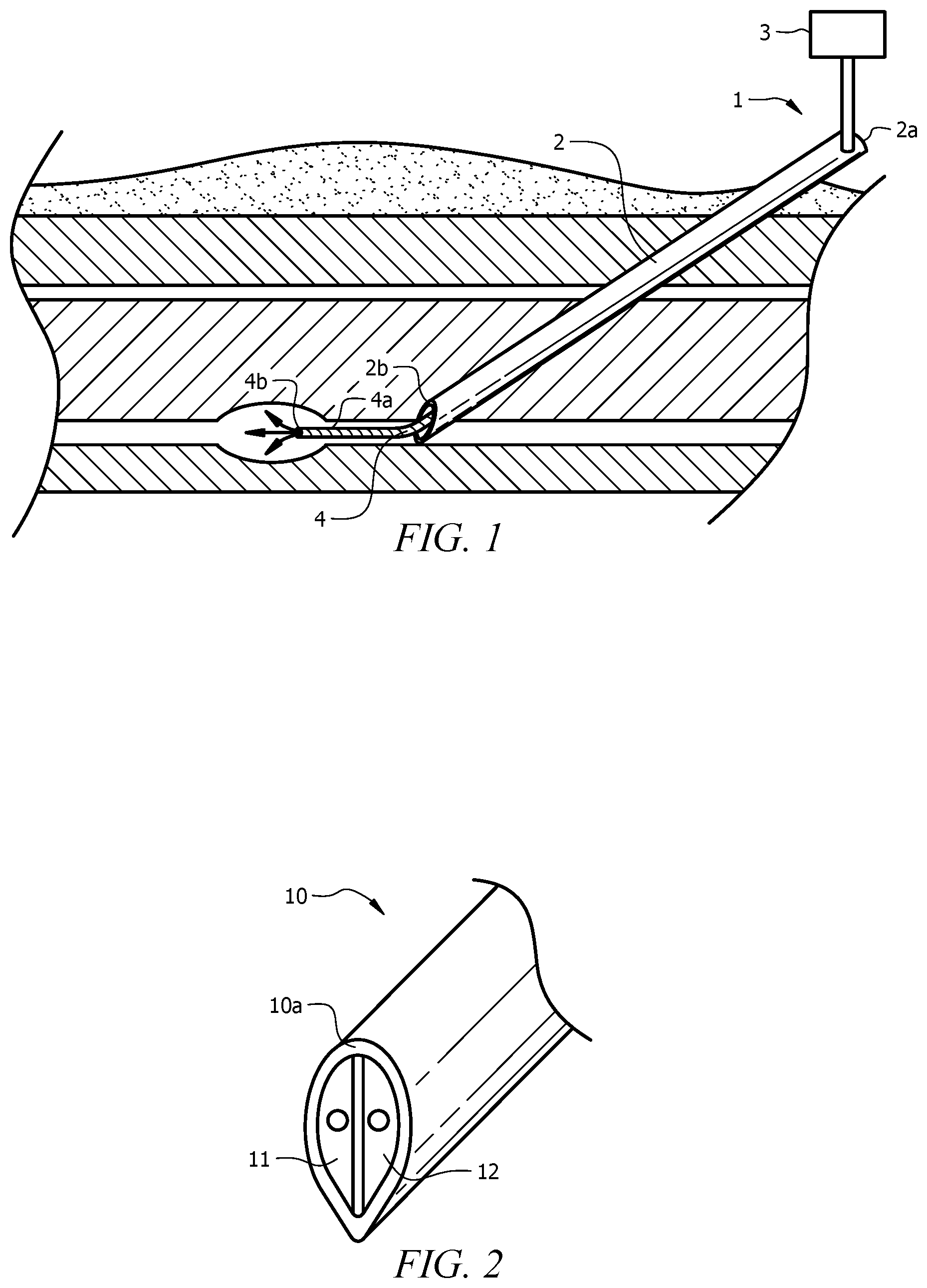 Patent US12318548 — Medical device for use in a nerve block procedure that obviates the need for injecting test doses and a method — Figure 1