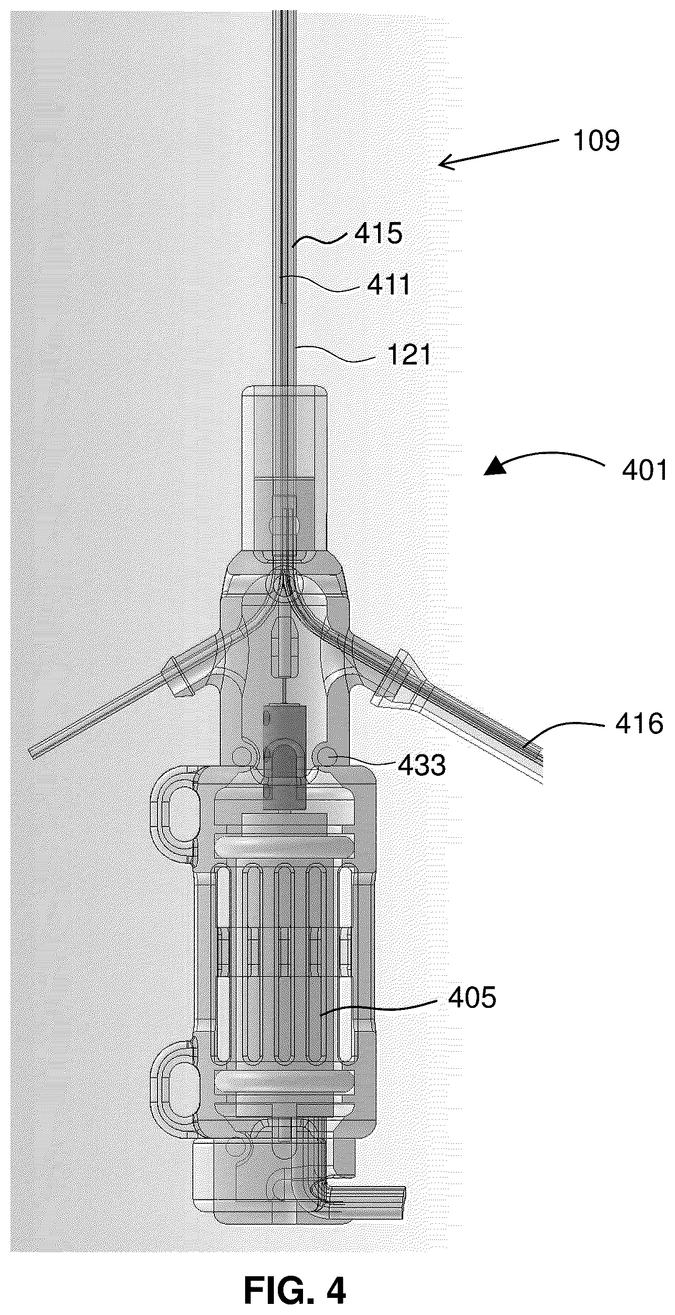 Patent US12318561 Figure 4 – Devices and methods for treating edema