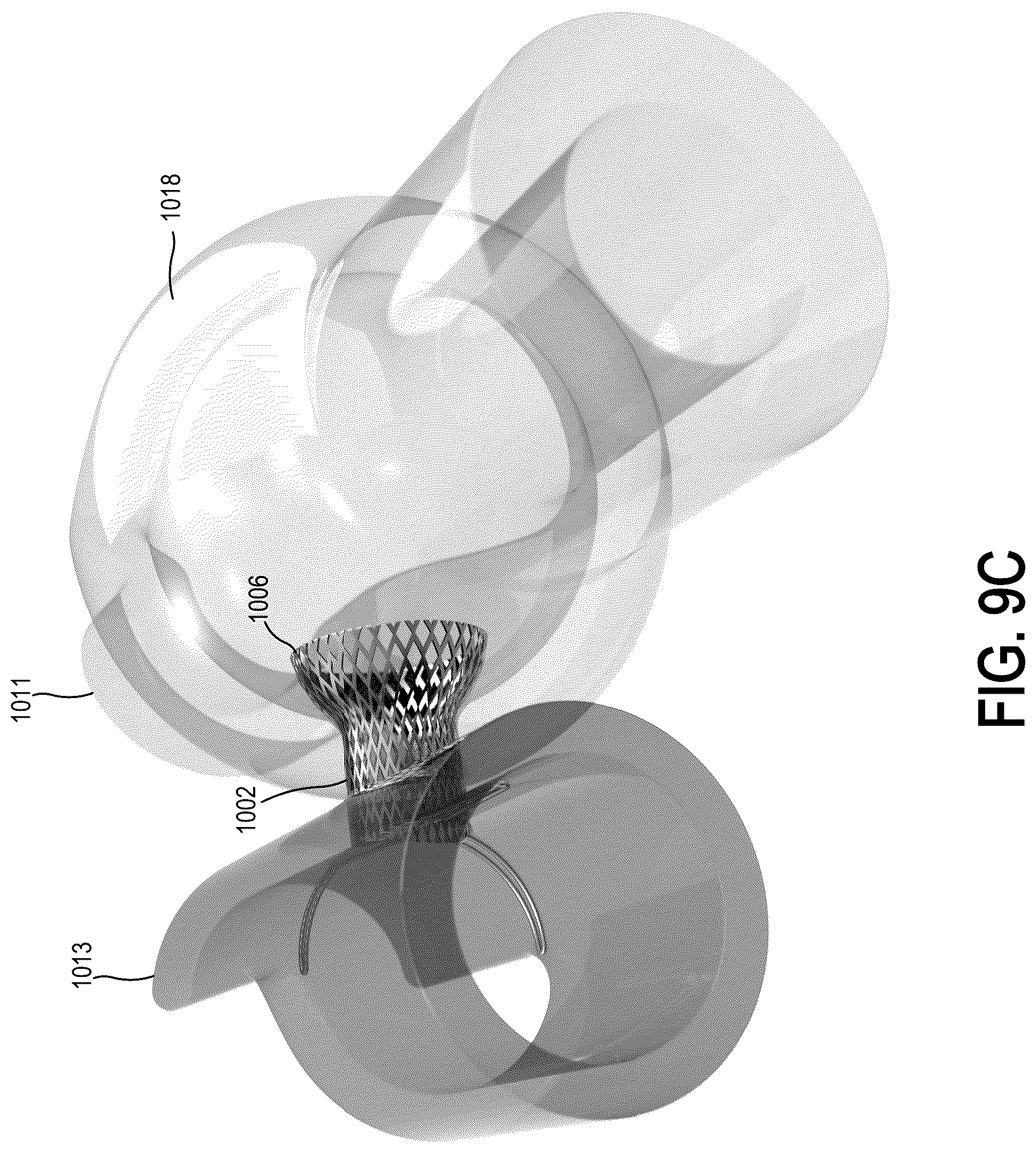 Patent US12318563 Figure 17 – Methods and systems for transcaval treatment of aneurysms