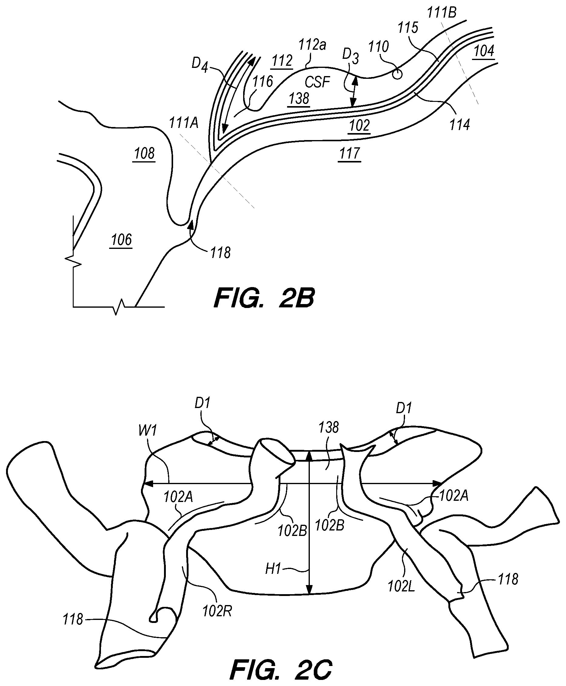 Patent US12318564 Figure 2 – Catheter systems and methods for medical procedures using catheters