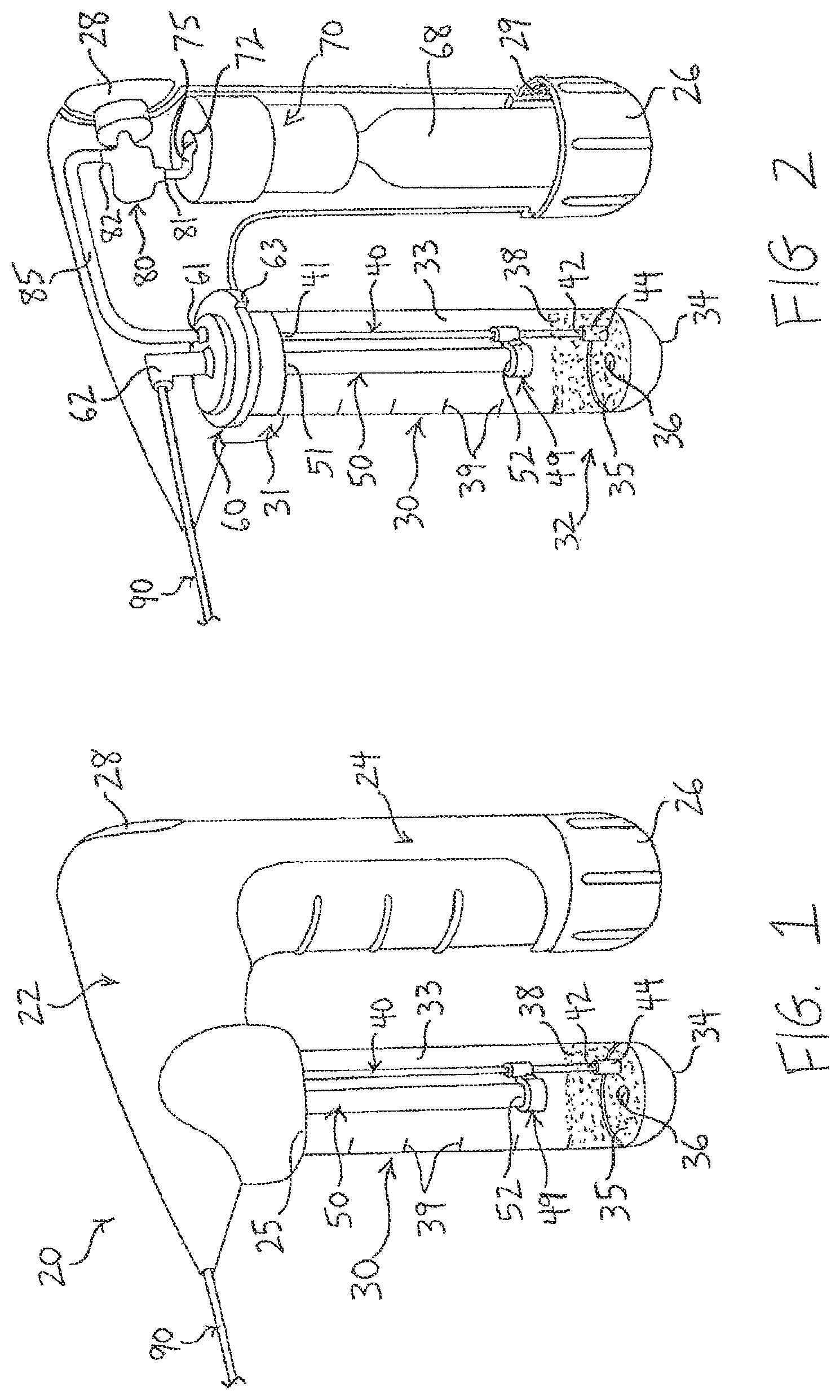 Patent US12318573 — Therapeutic agents for delivery using a catheter and pressure source — Figure 1