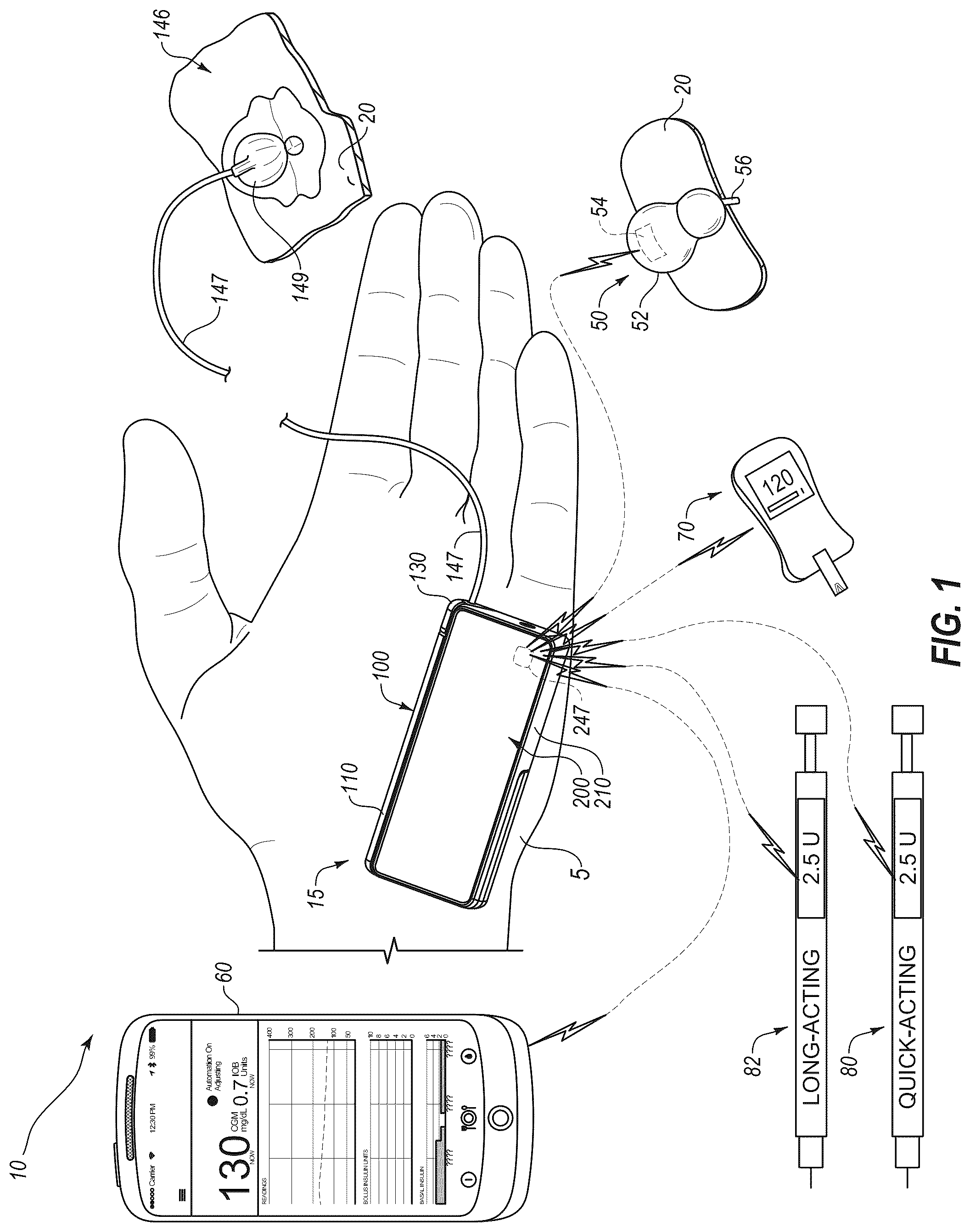 Patent US12318577 — System and method for adjusting insulin delivery — Figure 1