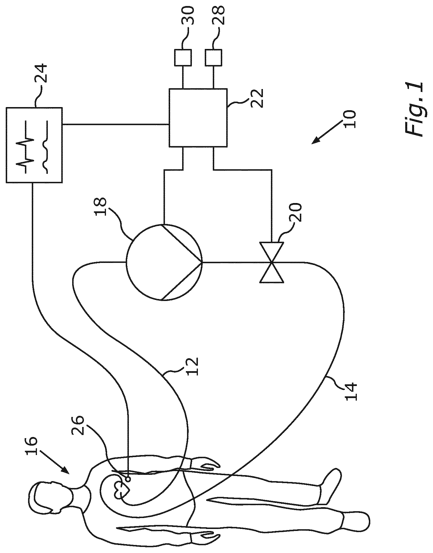 Patent US12318602 — System for cardiac assistance, method for operating the system and cardiac support method — Figure 1