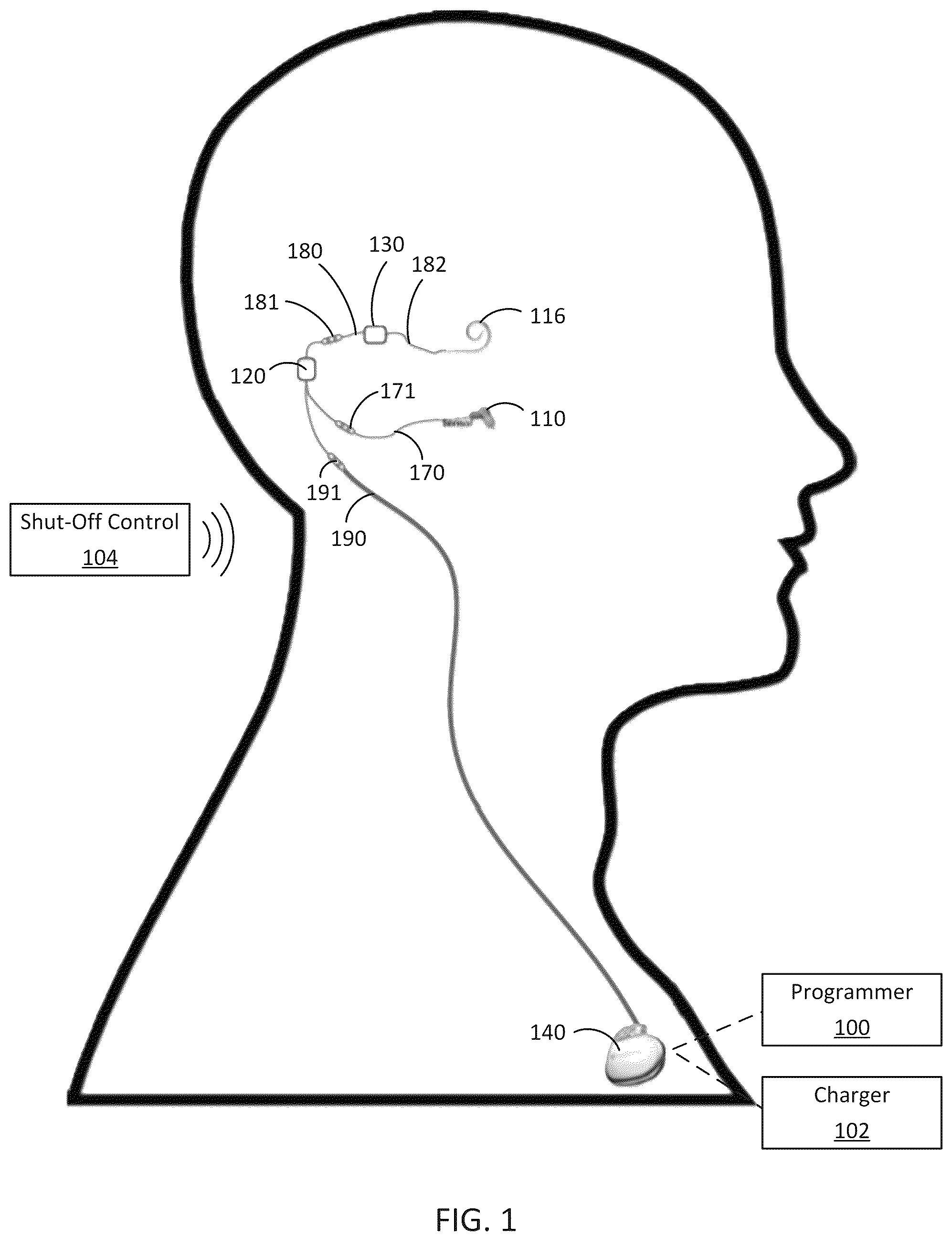 Patent US12318607 — Implantable cochlear system with integrated components and lead characterization — Figure 1