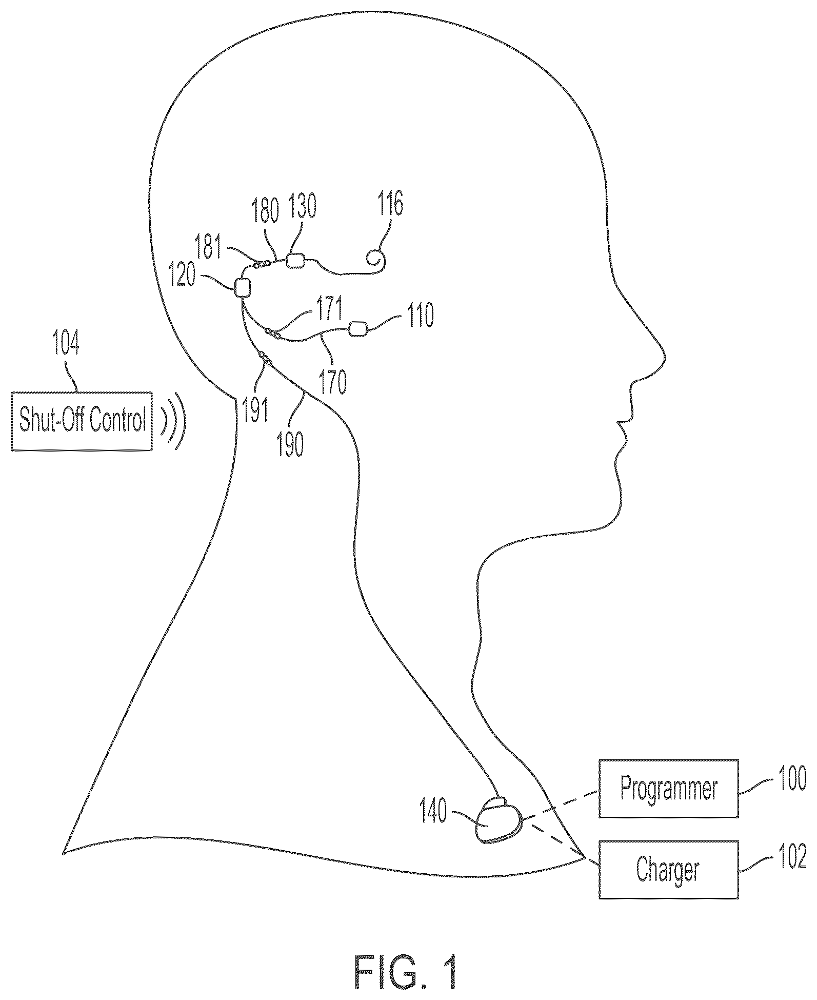 Patent US12318613 Figure 1 – Cochlear implant system with integrated signal analysis functionality