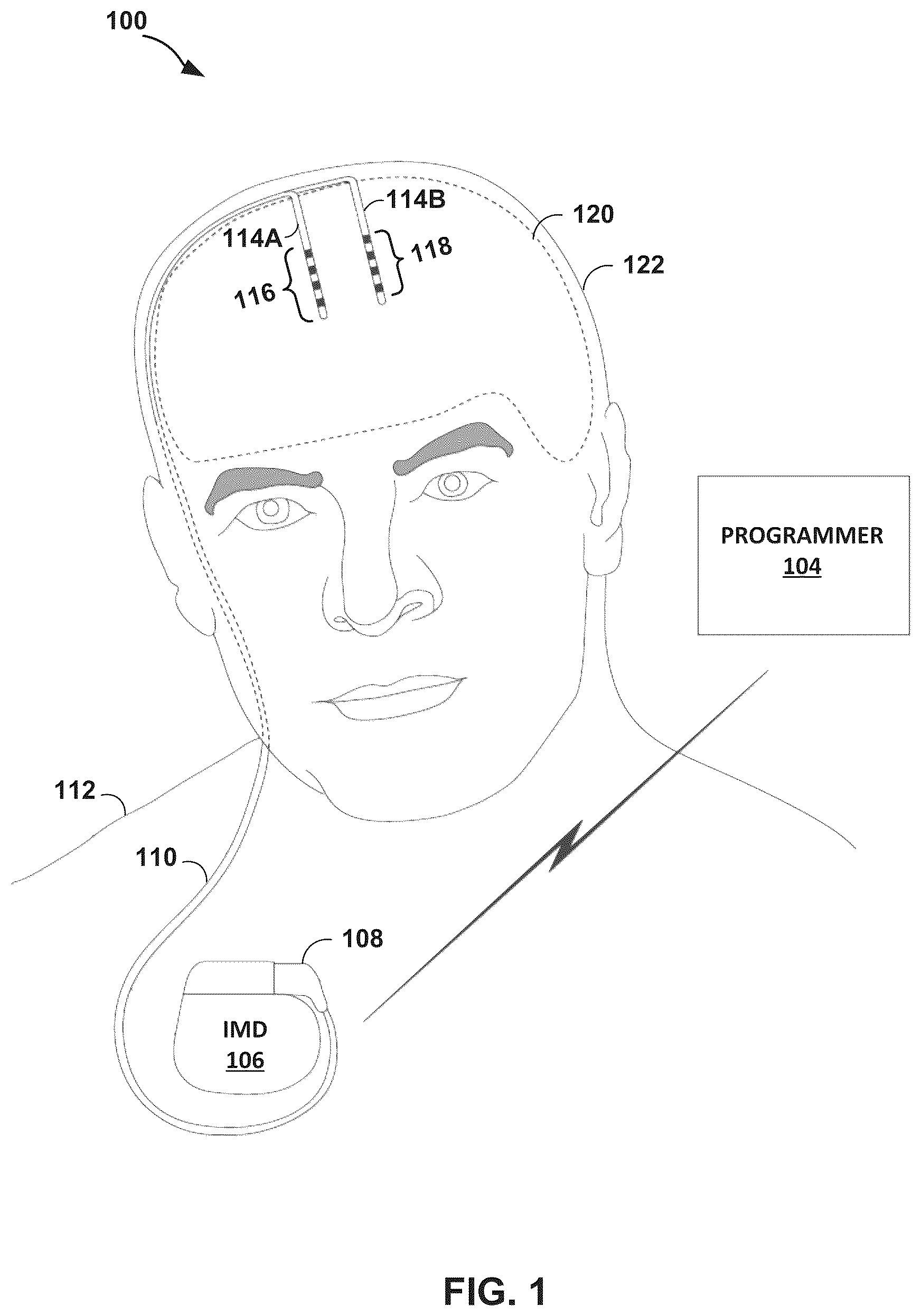 Patent US12318617 — Electrical stimulation therapy — Figure 1