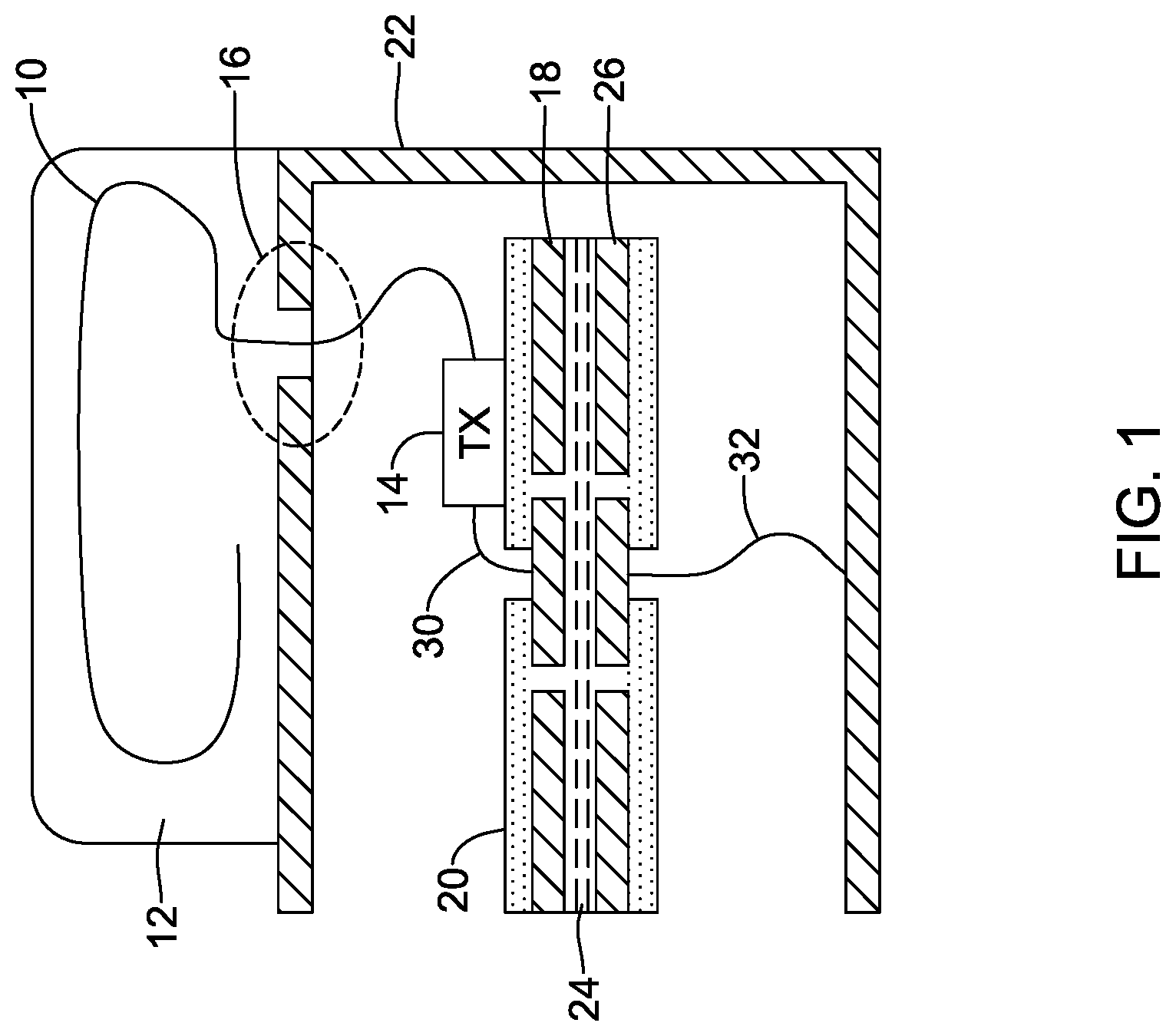 Patent US12318618 — Implantable medical device with feedthrough antenna ground structure — Figure 1
