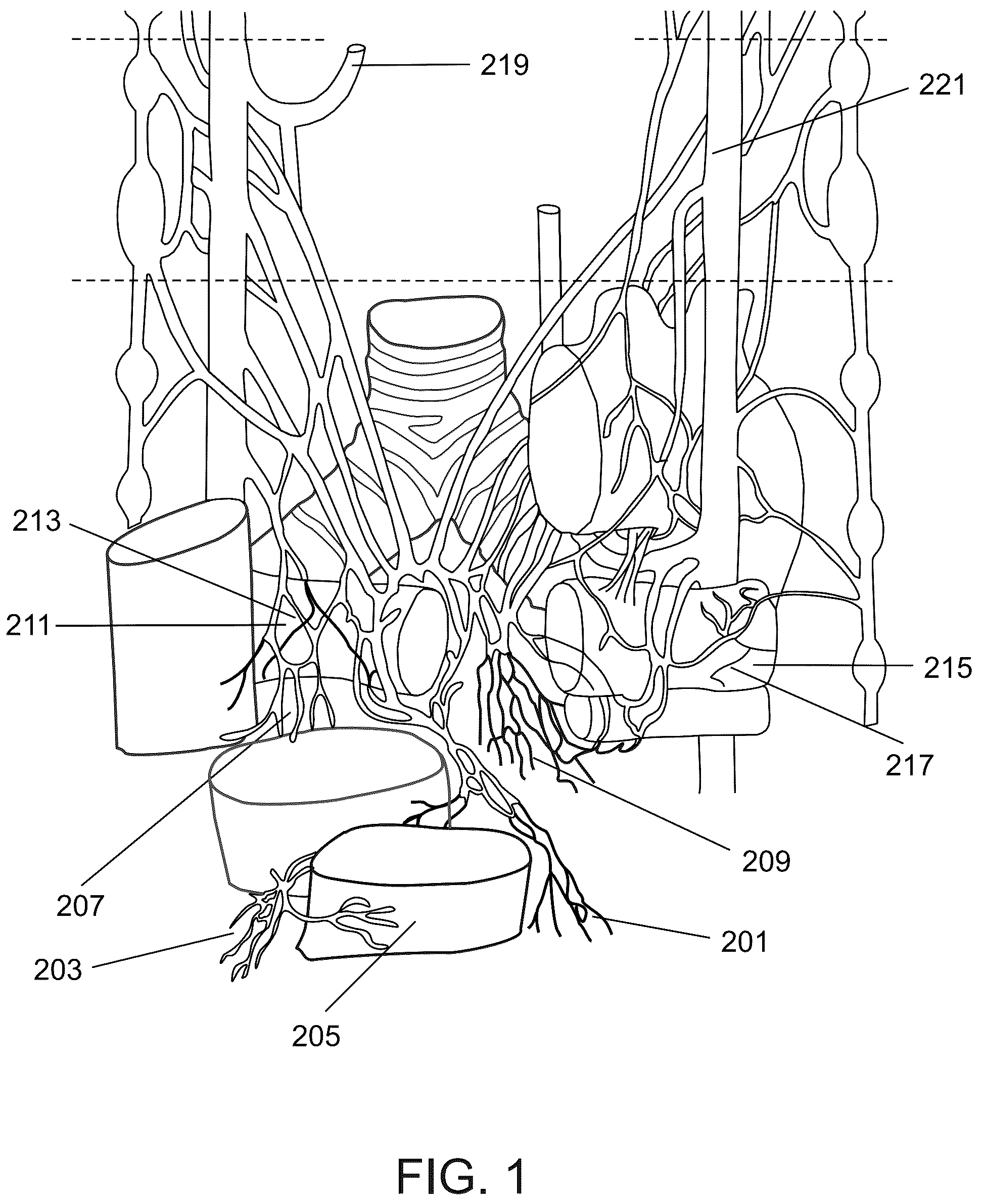 Patent US12318638 — Devices and methods for reducing parasympathetic nerve activity in patients with a respiratory syndrome — Figure 1