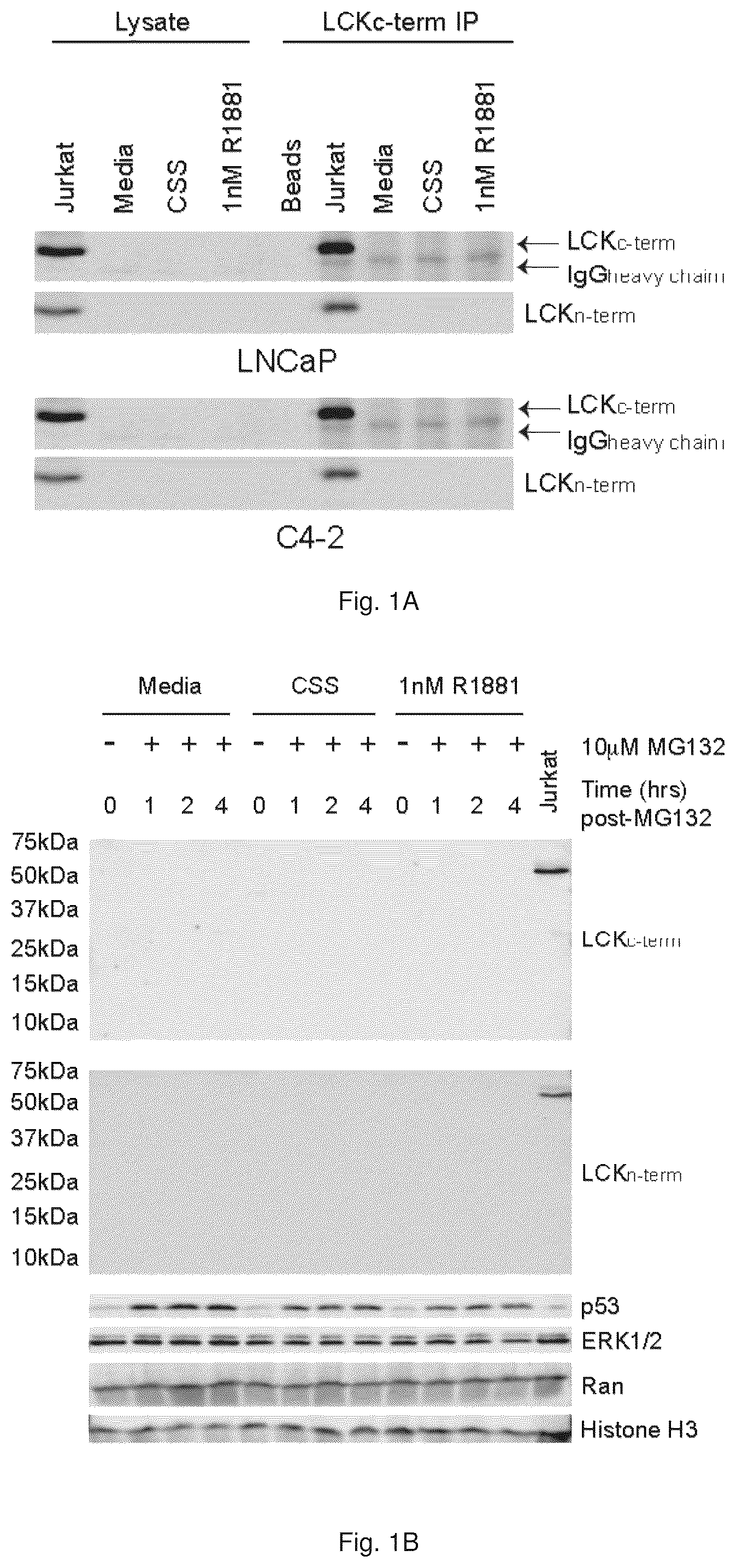 Patent US12319967 — Methods and compositions for diagnosing and treating prostate cancer based on long noncoding RNA overlapping the LCK gene that regulates prostate cancer cell growth — Figure 1