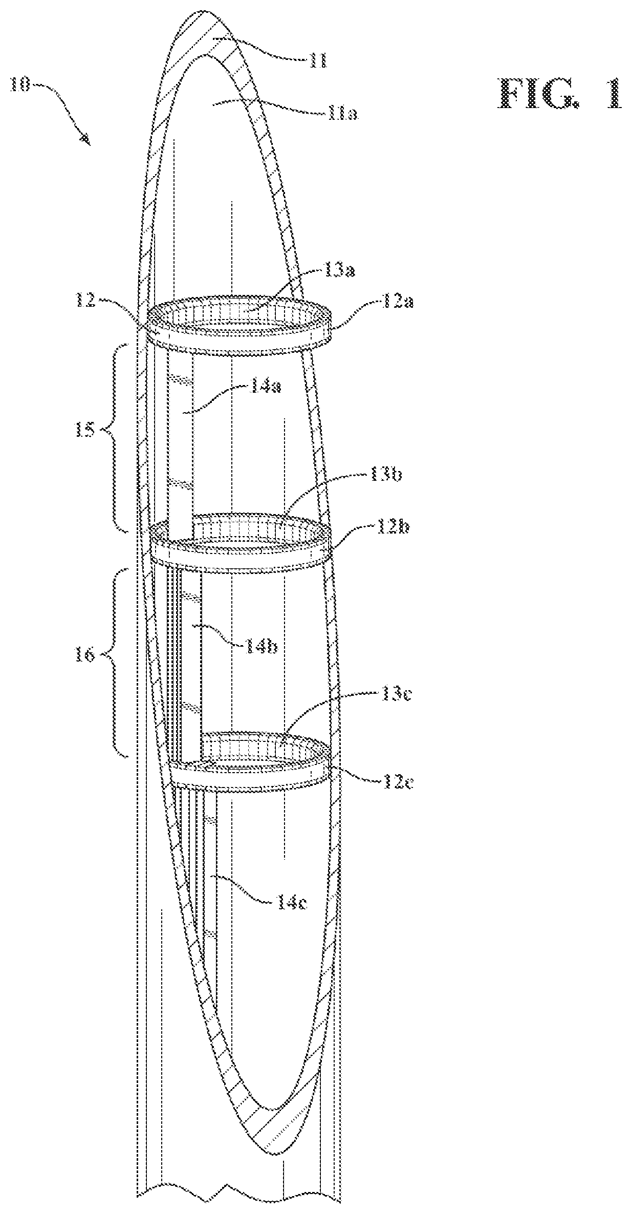 Patent US12320011 Figure 1 – Vitreous coating application by induction heating and integration with induction kinetic weld joining