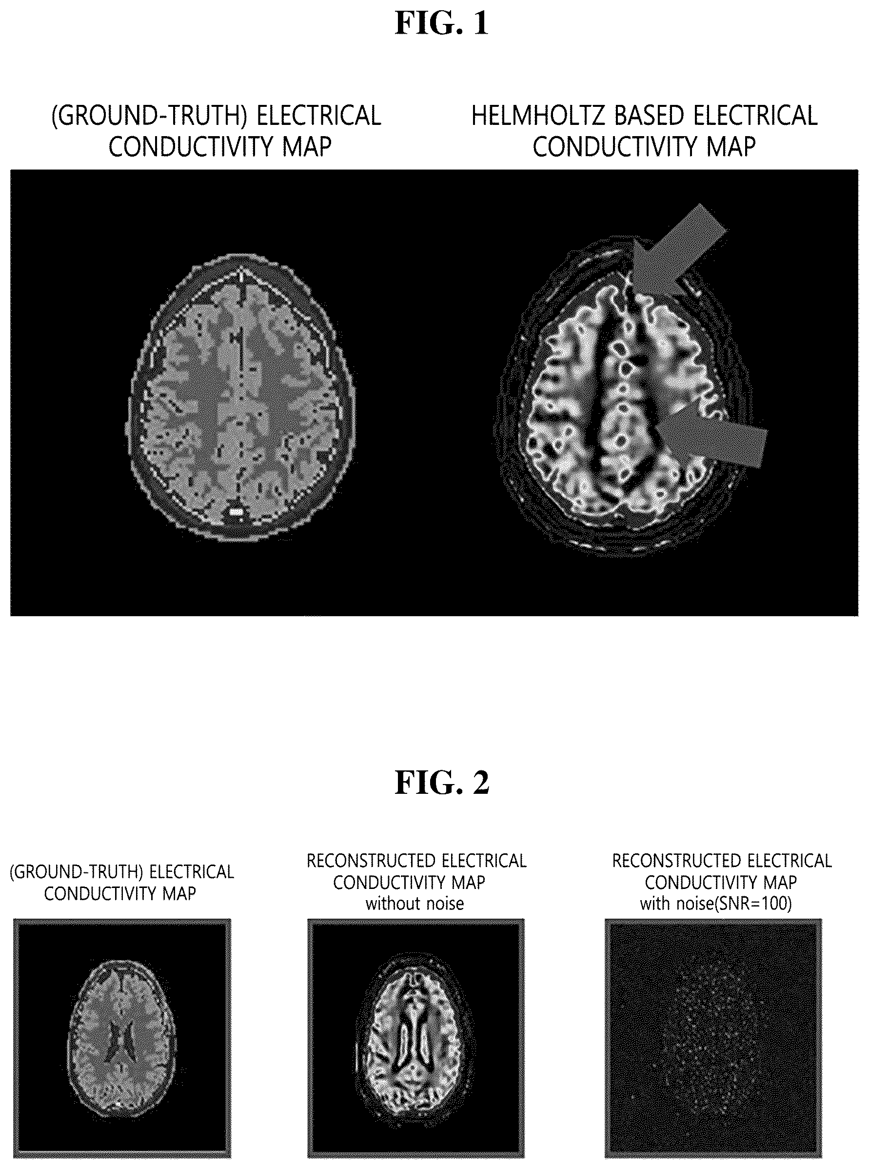 Patent US12320879 — Method and apparatus for reconstructing an electrical conductivity map from magnetic resonance imaging — Figure 1