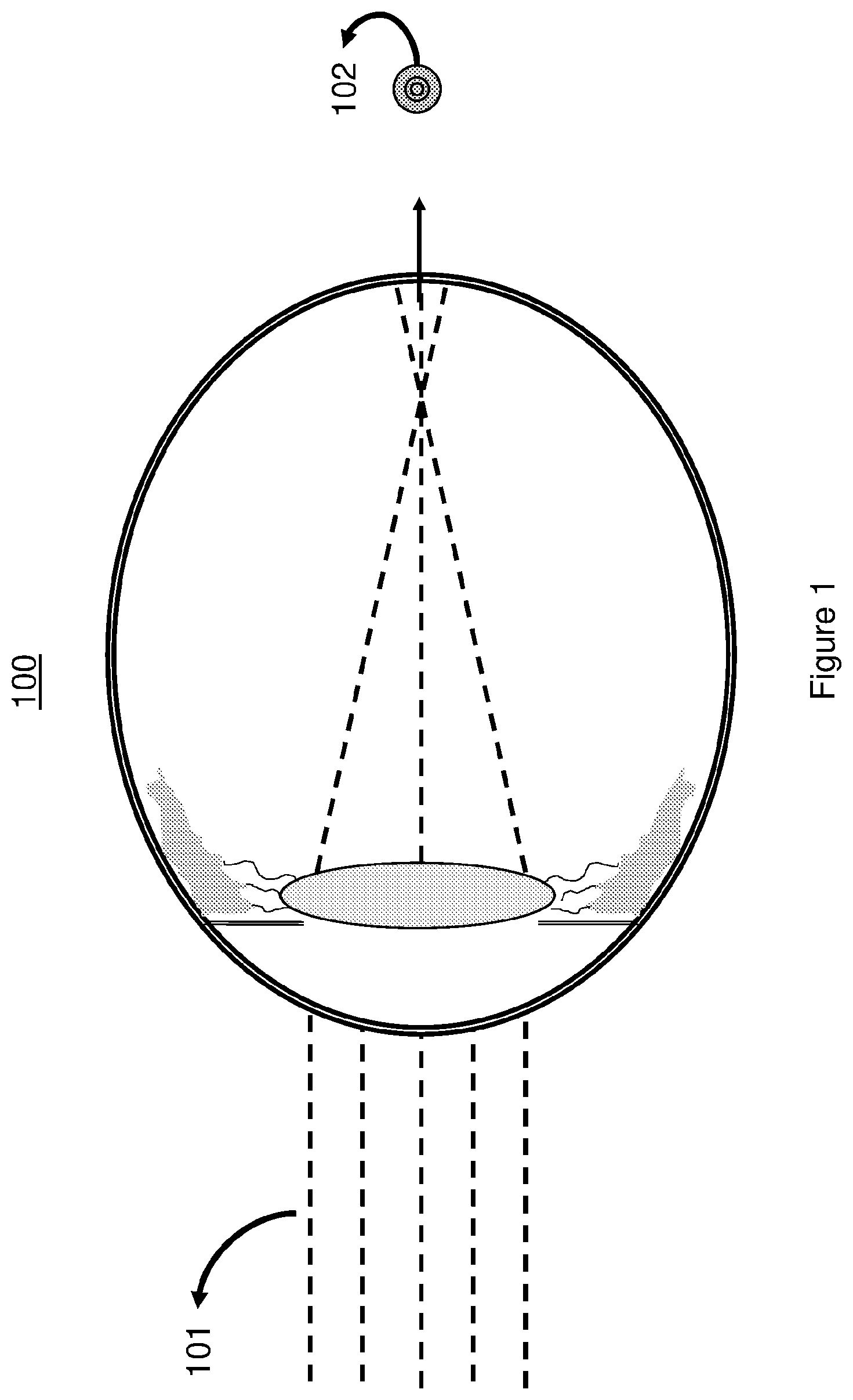 Patent US12321046 — Spectacle lenses with auxiliary optical elements — Figure 1