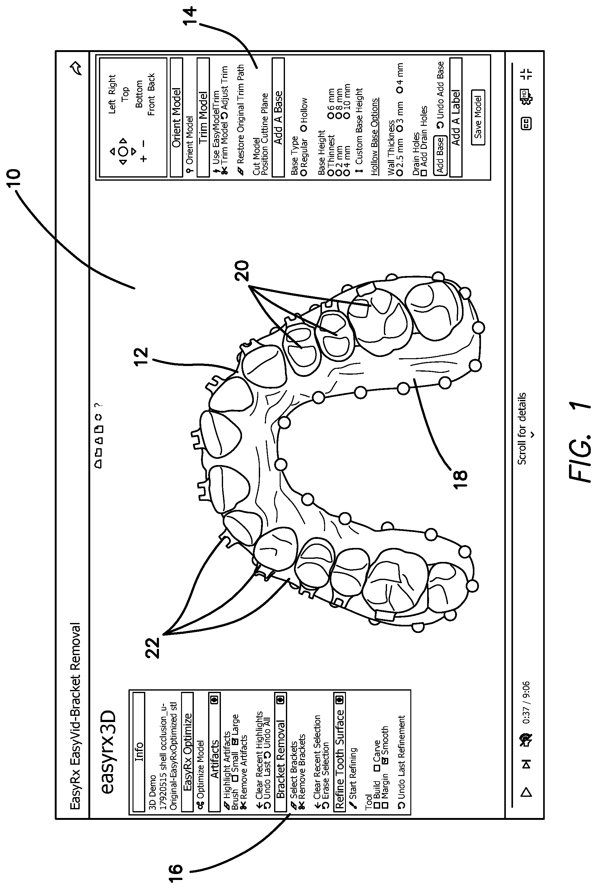 Patent US12322059 — System and method for removing brackets from customized orthodontic appliances and products — Figure 1